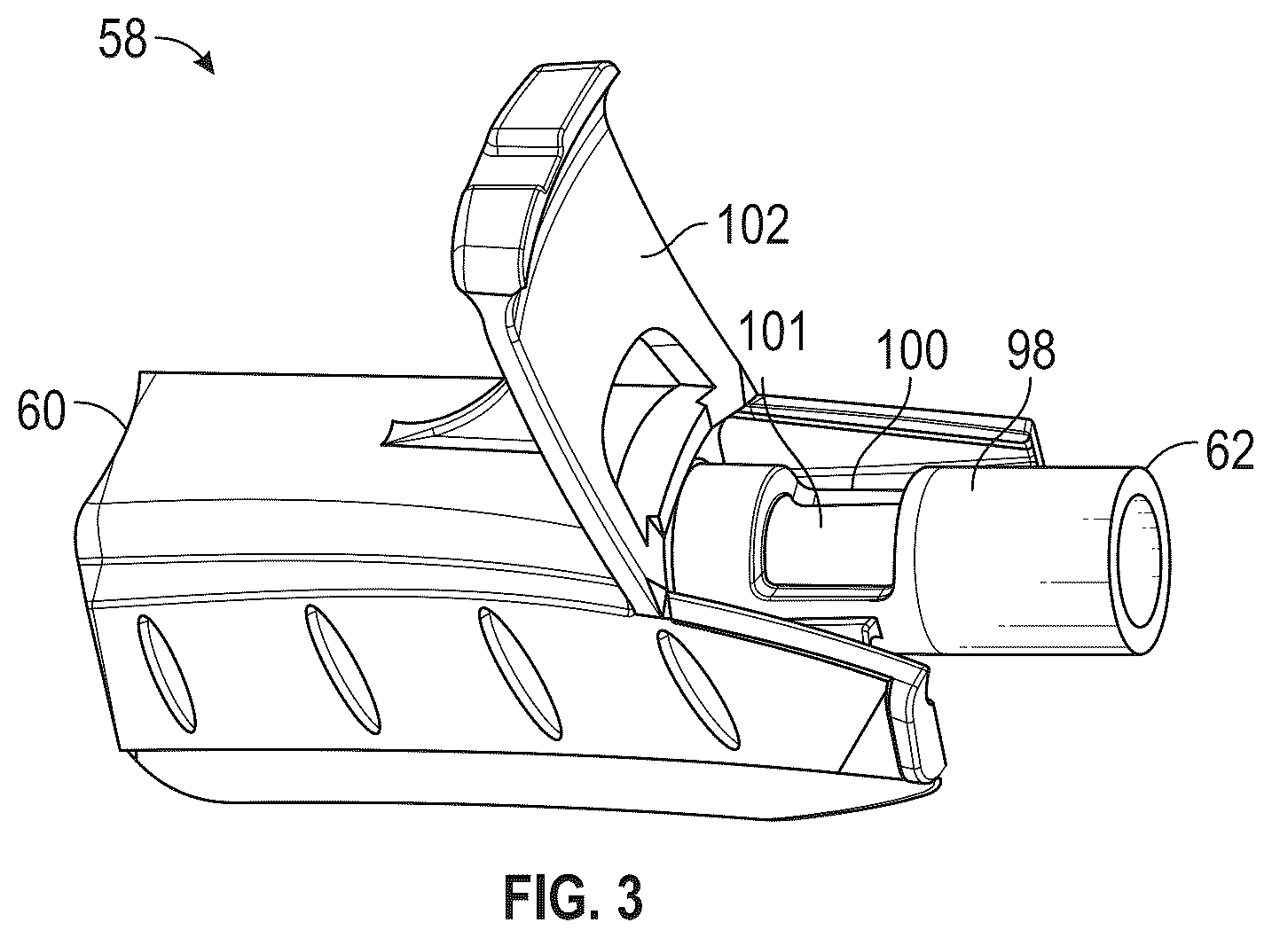 Patent US12350453 Figure 3 – Catheter system facilitating blood flashback visualization