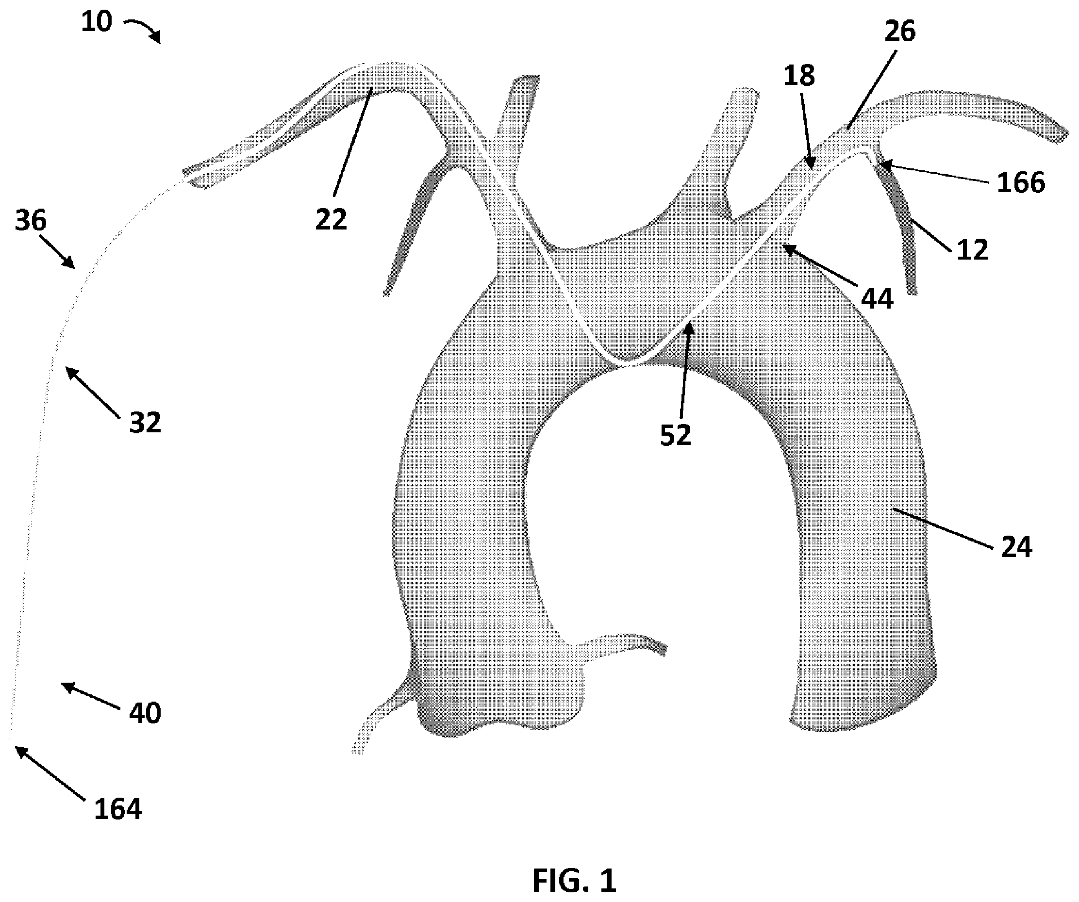 Patent US12350454 — LIMA crossover integrated catheter system — Figure 1