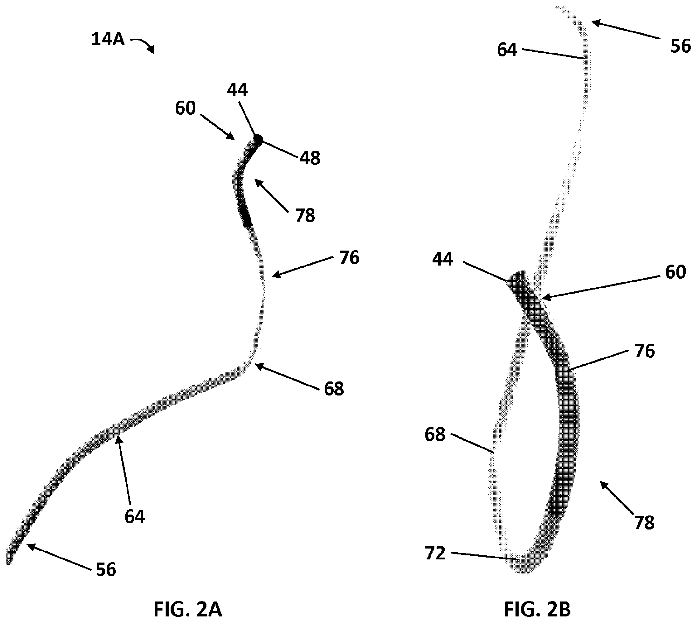 Patent US12350454 Figure 2 – LIMA crossover integrated catheter system