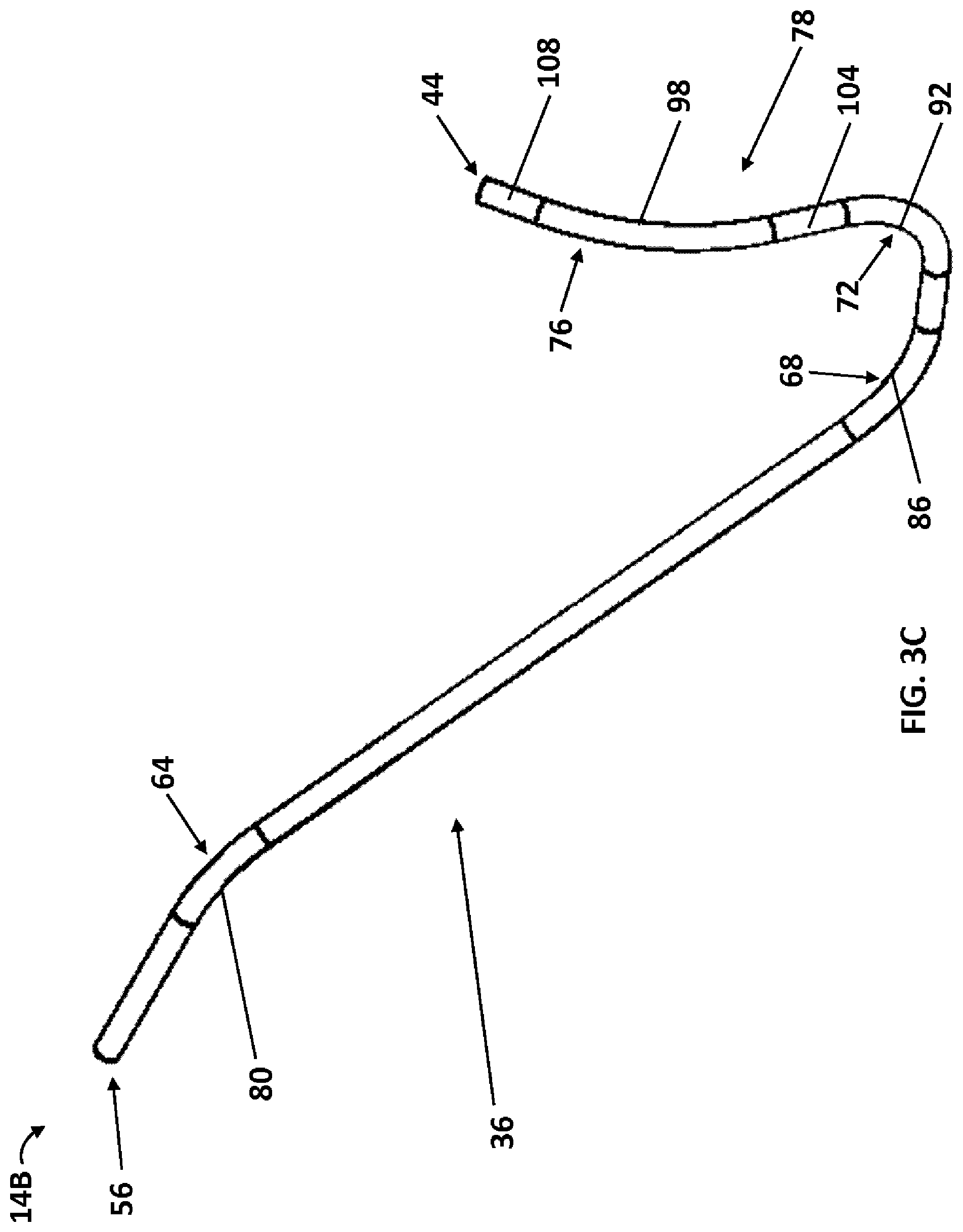 Patent US12350454 Figure 4 – LIMA crossover integrated catheter system