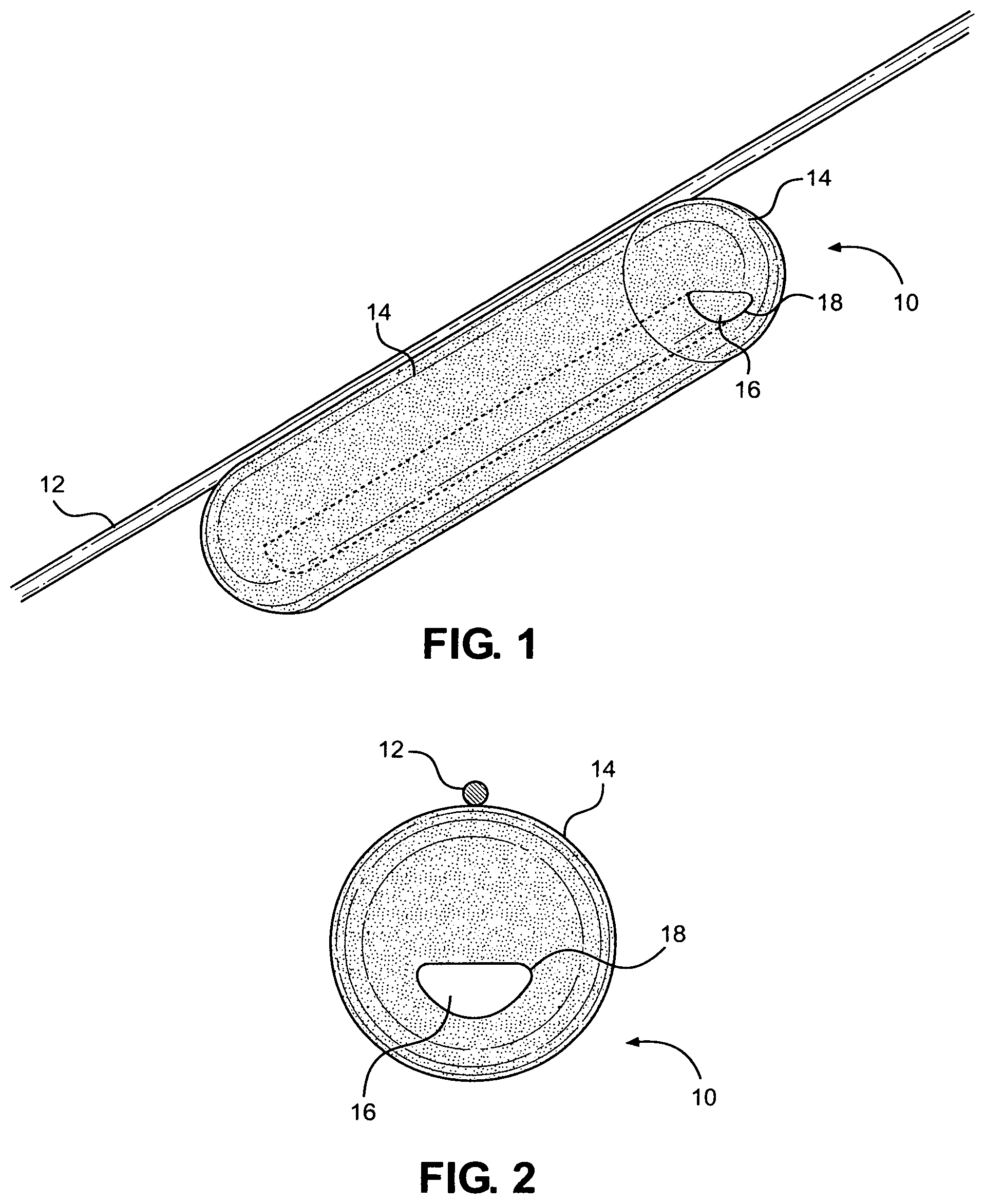 Patent US12350455 Figure 1 – Angioplasty balloon snare