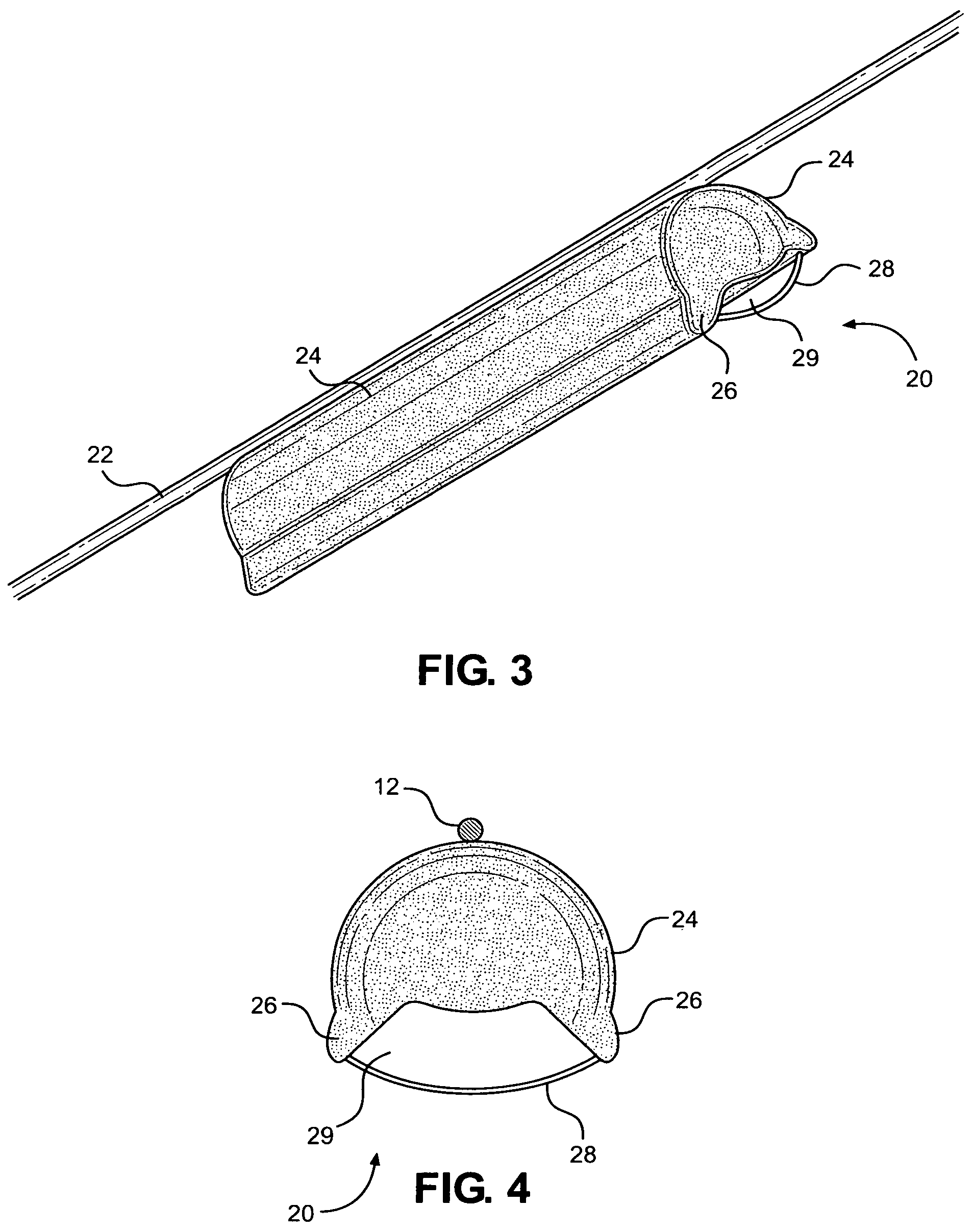 Patent US12350455 Figure 2 – Angioplasty balloon snare