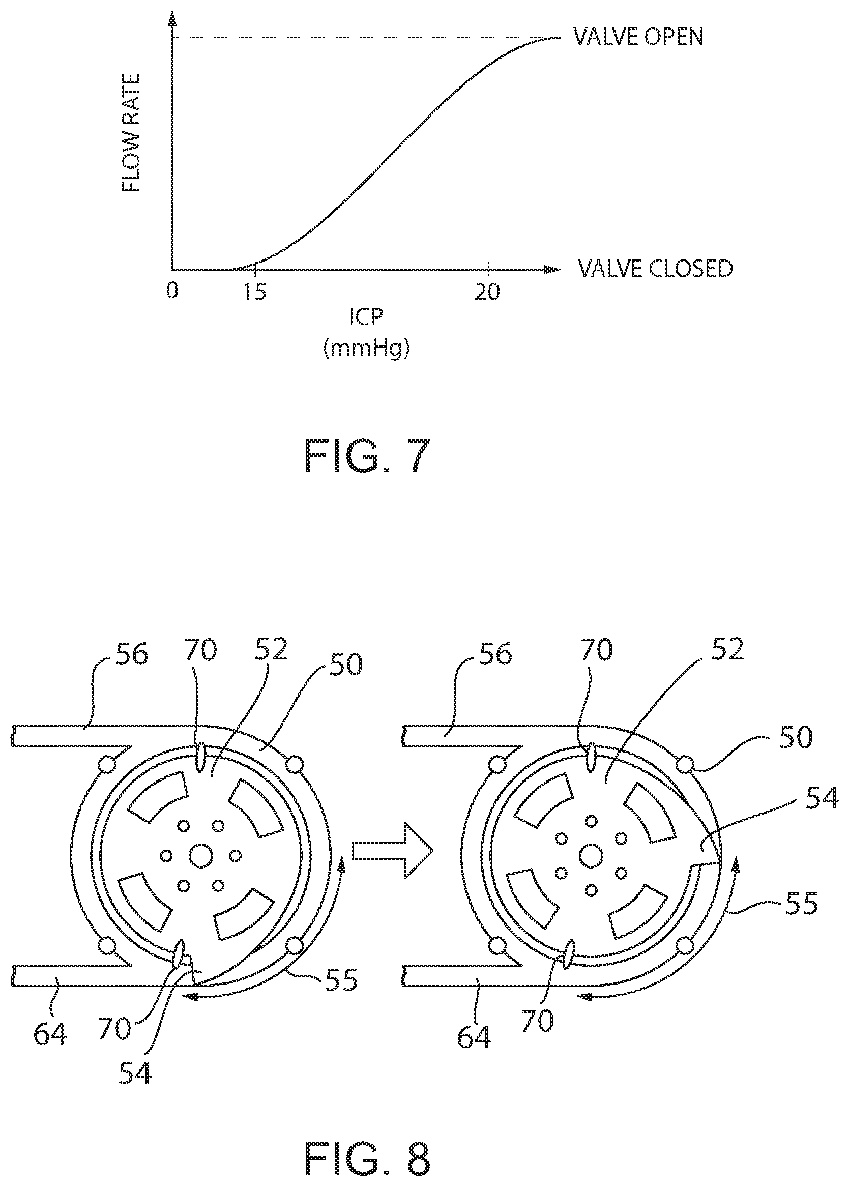 Patent US12350456 Figure 4 – Automatic in vitro diagnostic medical device for intraventricular drainage