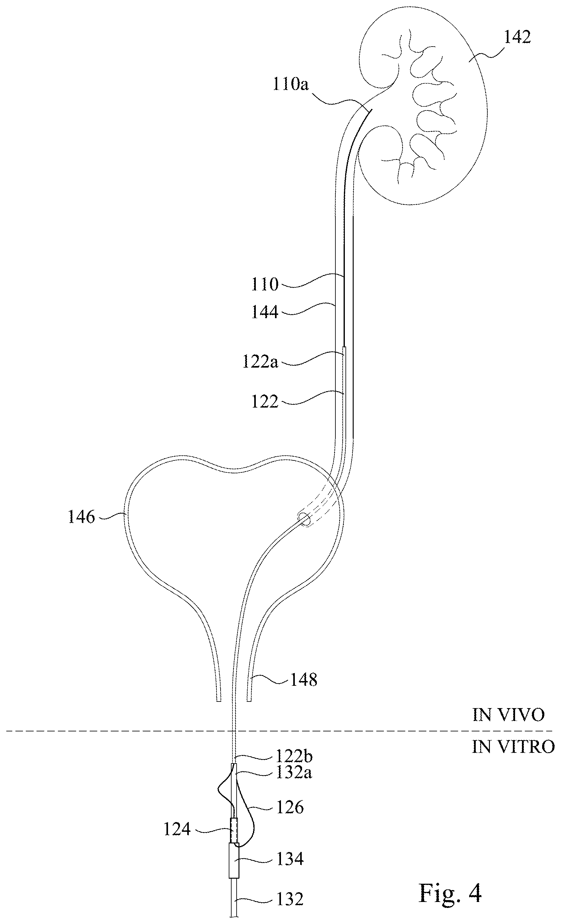 Patent US12350457 Figure 4 – Ureteral stent assembly and stent pusher thereof