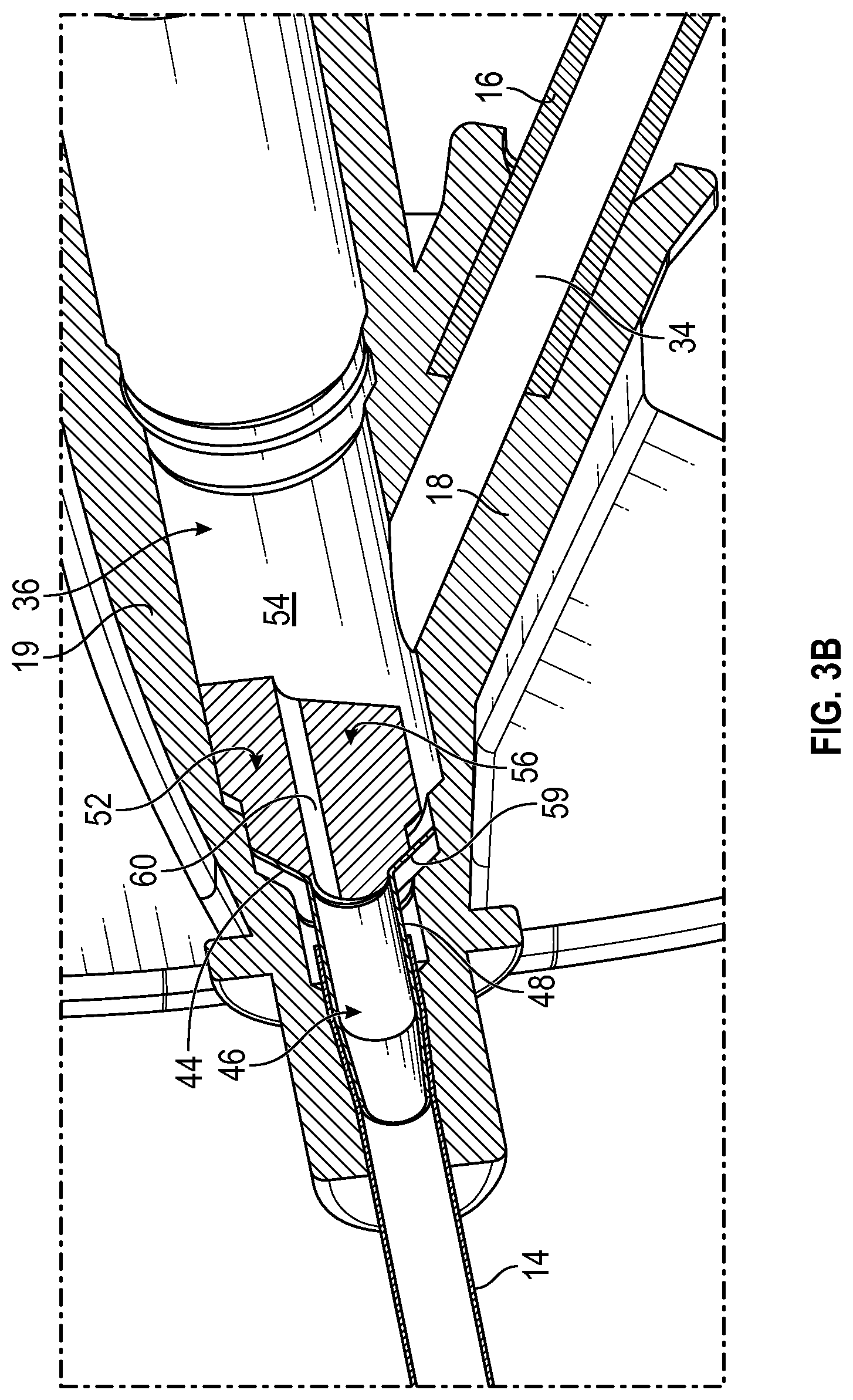 Patent US12350461 Figure 6 – Systems and methods of facilitating instrument delivery to a catheter assembly