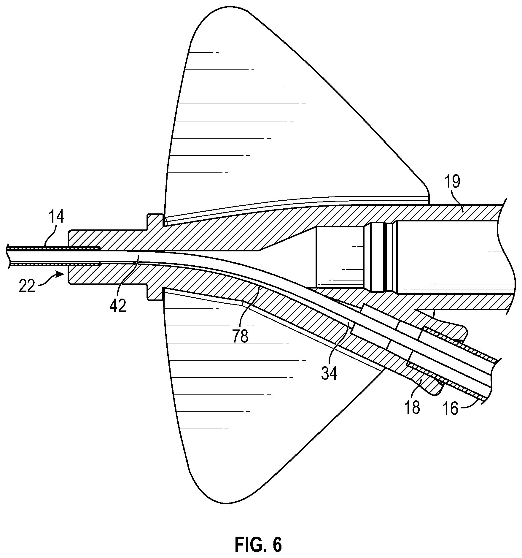 Patent US12350461 Figure 11 – Systems and methods of facilitating instrument delivery to a catheter assembly