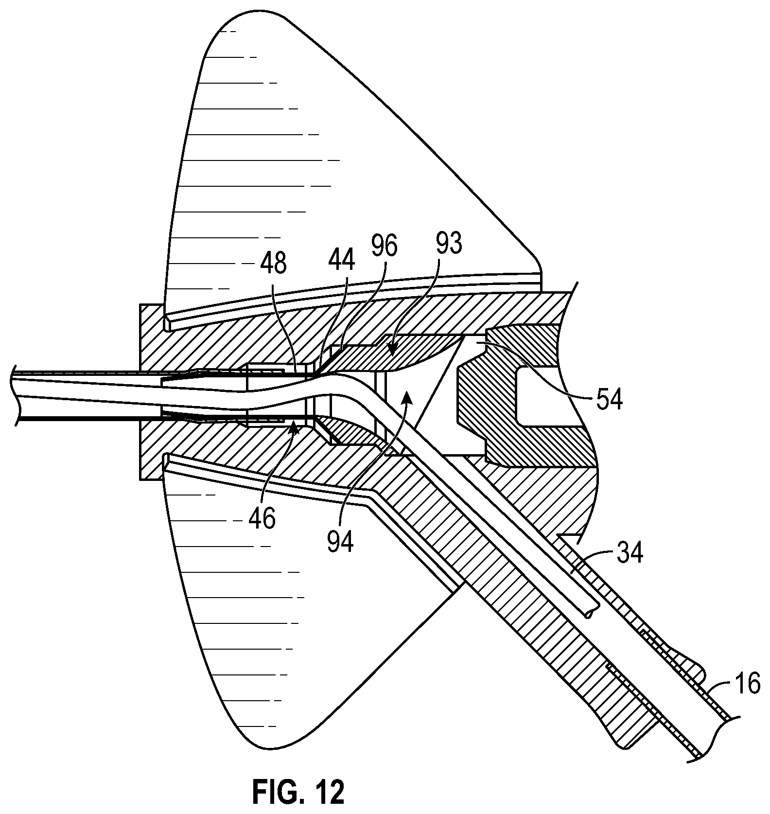 Patent US12350461 Figure 17 – Systems and methods of facilitating instrument delivery to a catheter assembly