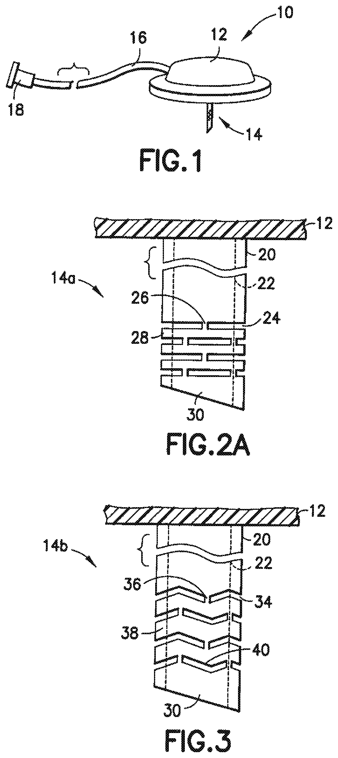 Patent US12350465 Figure 1 – Infusion set and/or patch pump having at least one of an in-dwelling rigid catheter with flexible features and/or a flexible catheter attachment