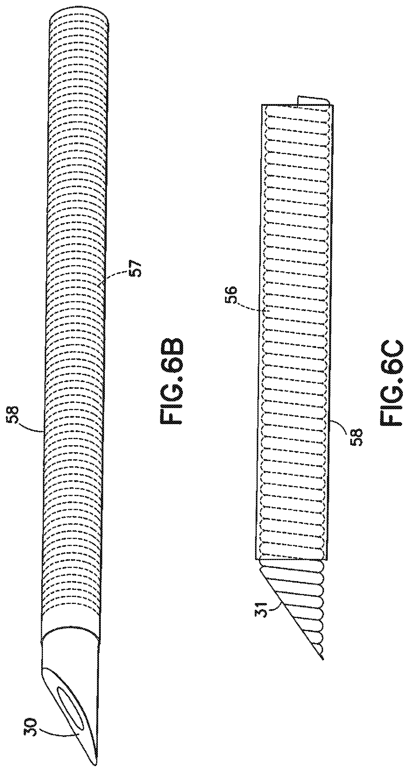 Patent US12350465 Figure 6 – Infusion set and/or patch pump having at least one of an in-dwelling rigid catheter with flexible features and/or a flexible catheter attachment