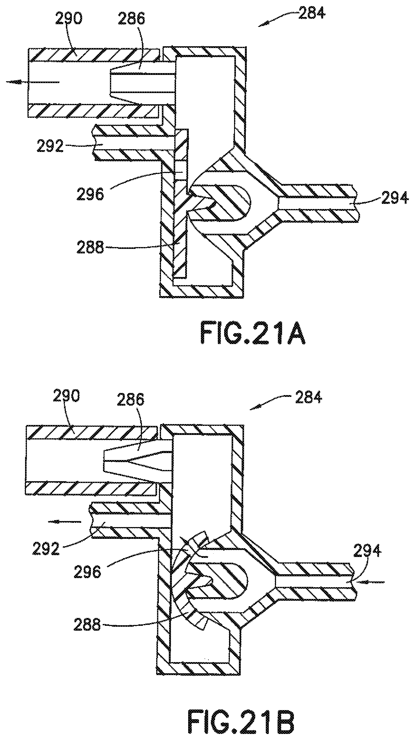 Patent US12350465 Figure 17 – Infusion set and/or patch pump having at least one of an in-dwelling rigid catheter with flexible features and/or a flexible catheter attachment