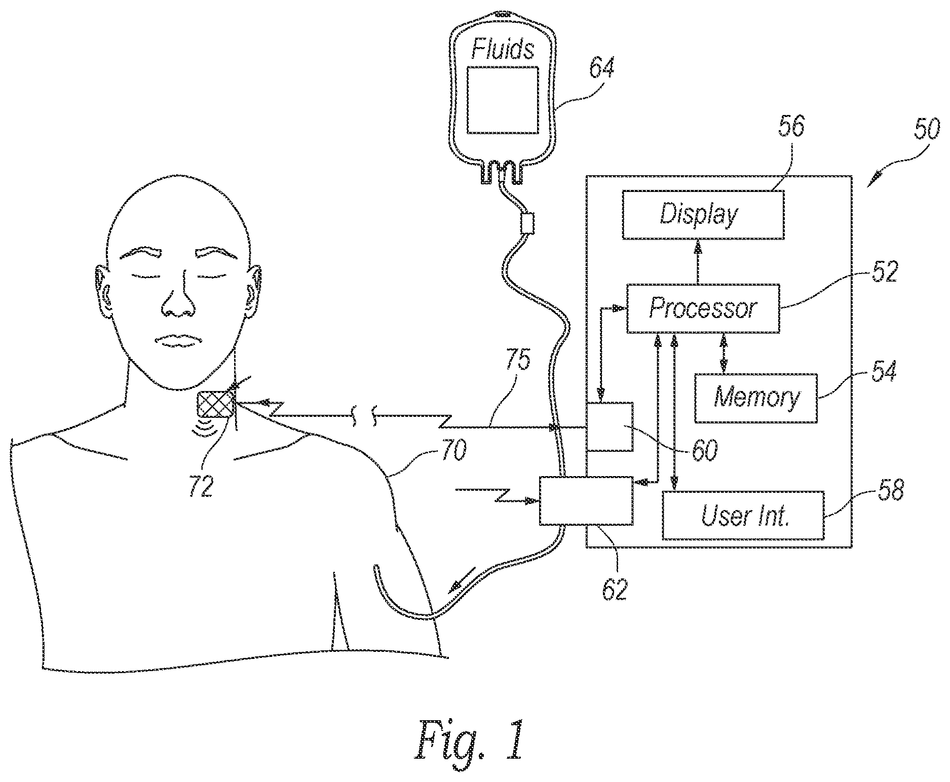 Patent US12350468 — Dynamically controllable patient fluid control device — Figure 1