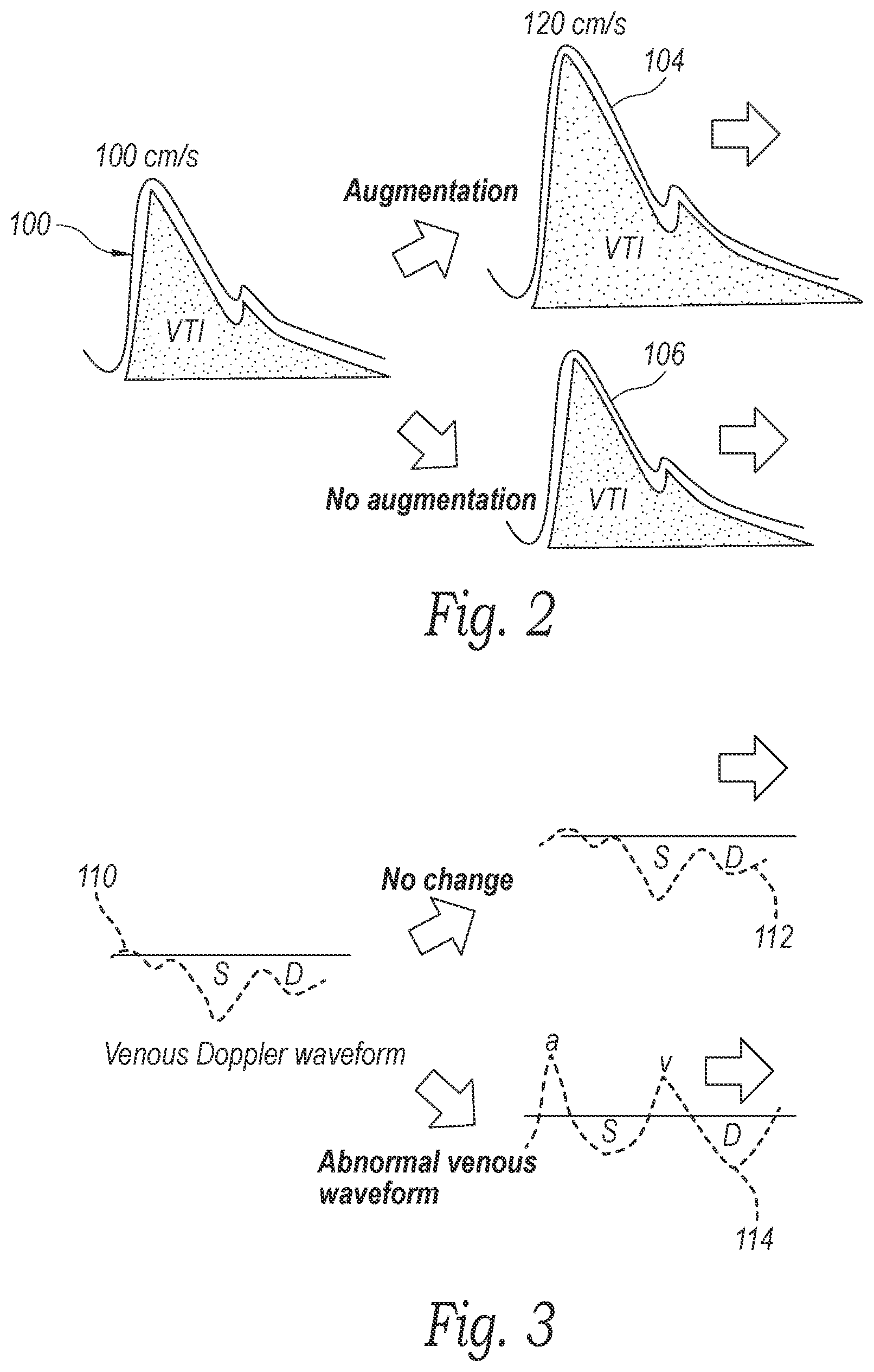 Patent US12350468 Figure 2 – Dynamically controllable patient fluid control device