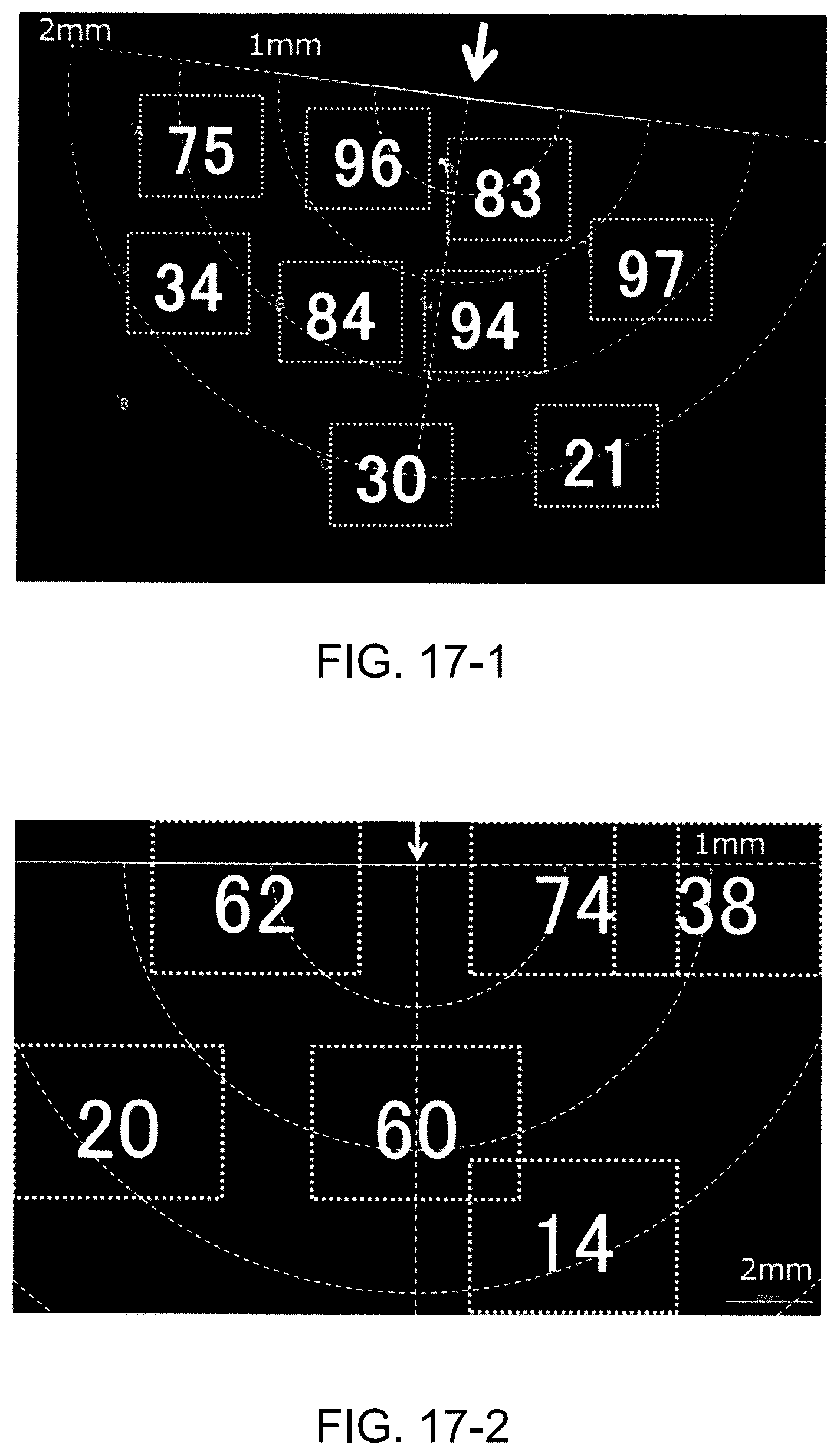 Patent US12350471 Figure 17 – Measurement system, measurement method, injector, and method for injecting biomolecule-containing solution into to-be-injected cell using same