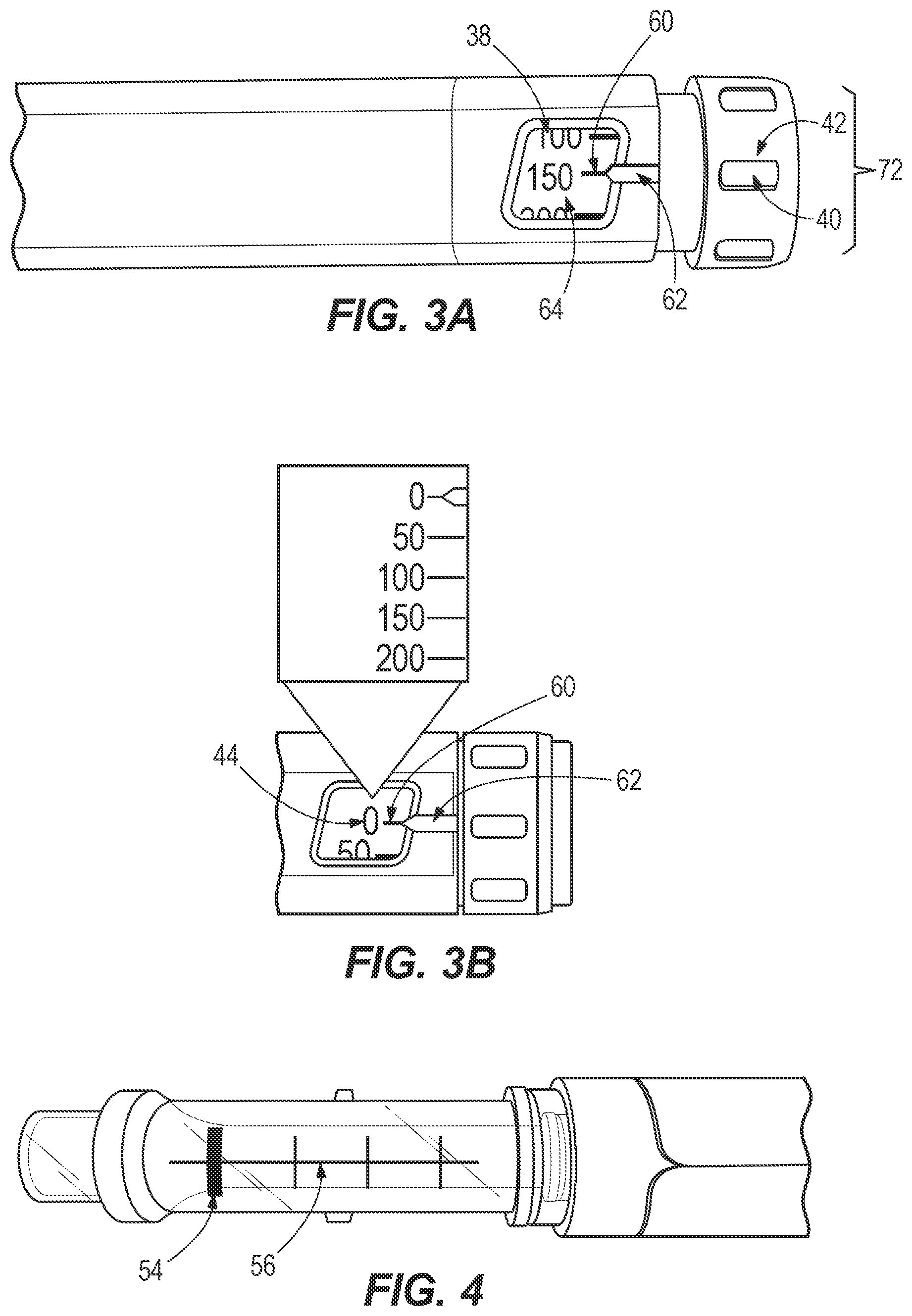 Patent US12350475 Figure 3 – Method of injecting octreotide acetate into the body