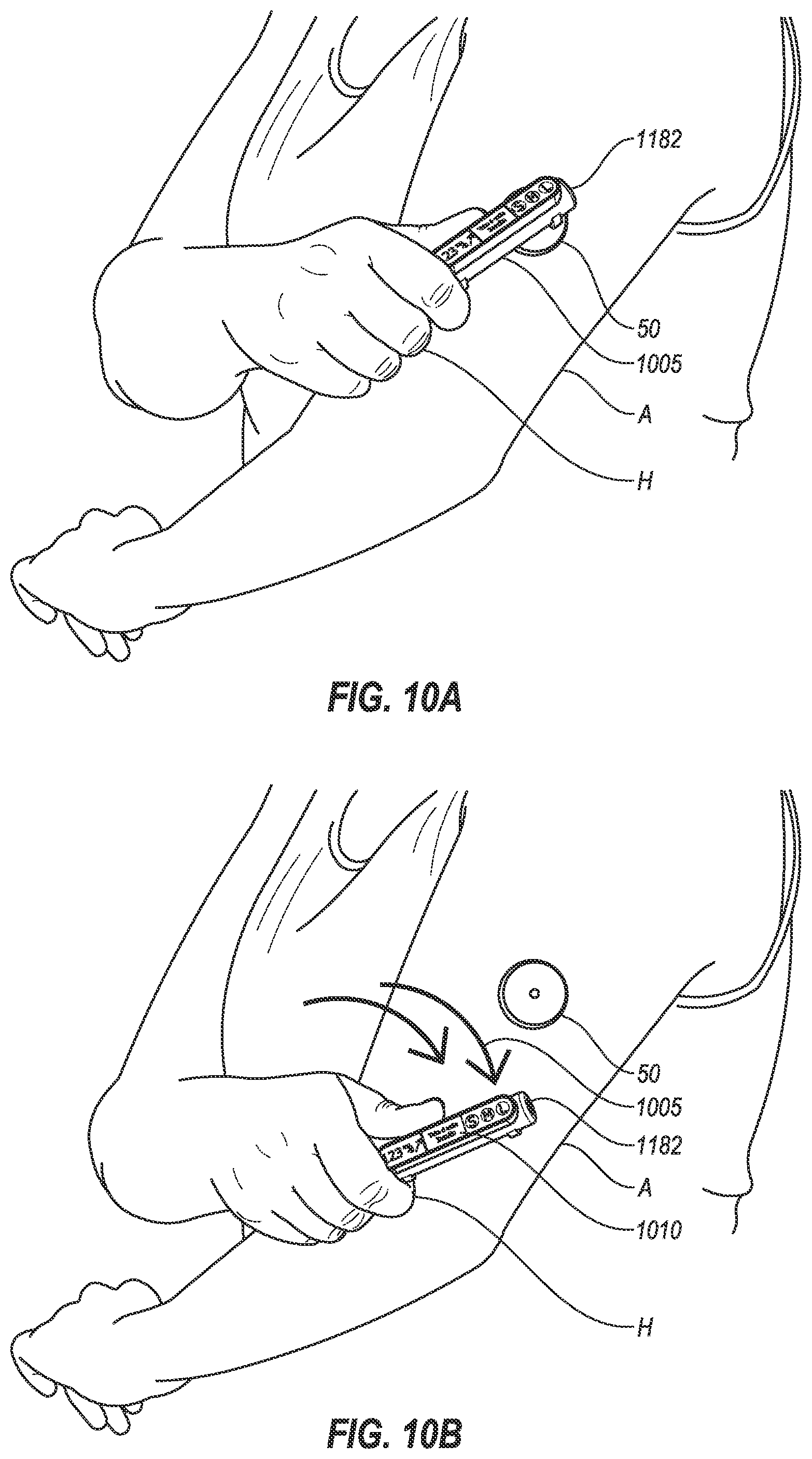 Patent US12350479 Figure 14 – Medicine injection and disease management systems, devices, and methods