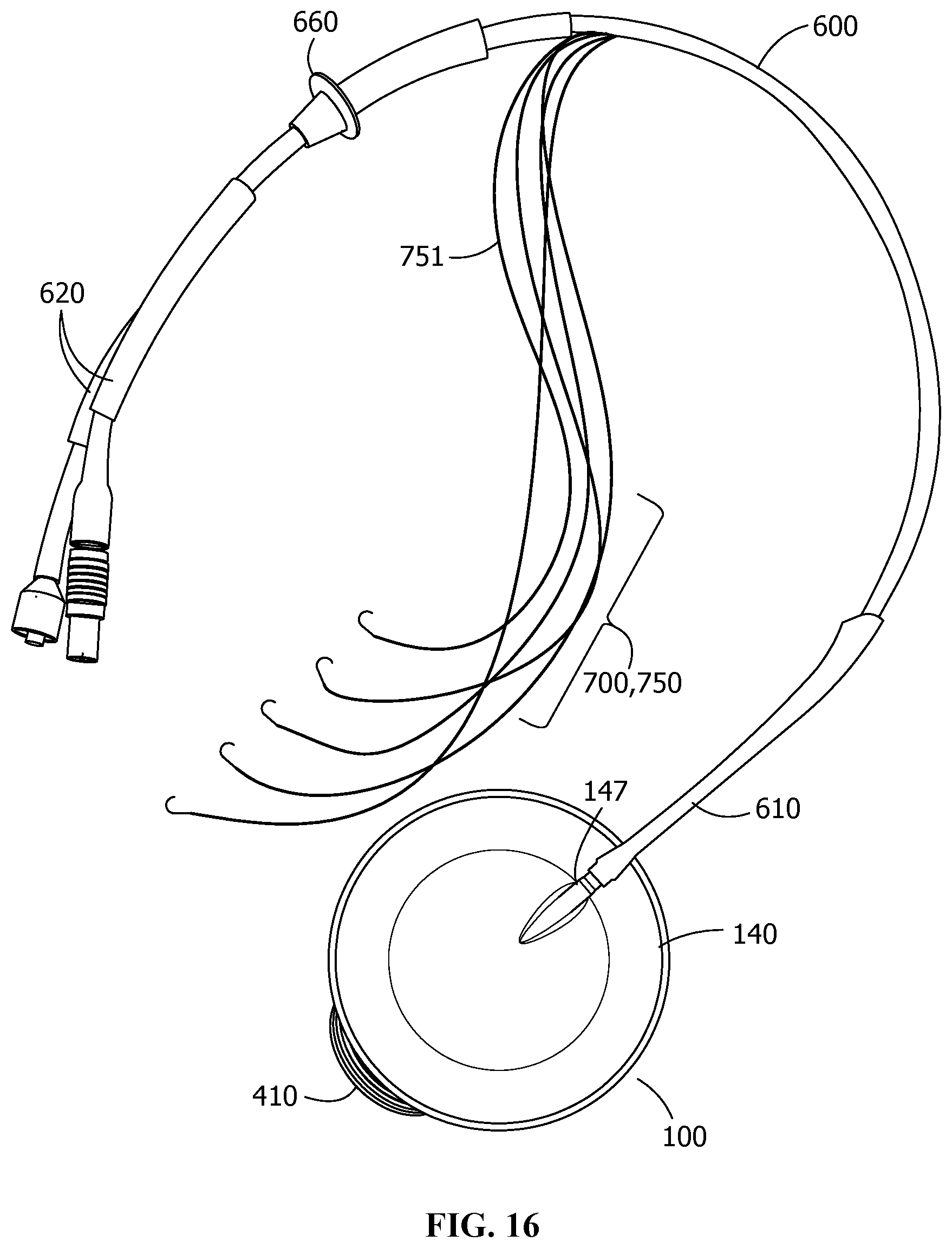 Patent US12350481 Figure 6 – Pressure unloading left ventricular assist device and methods for assisting a human heart