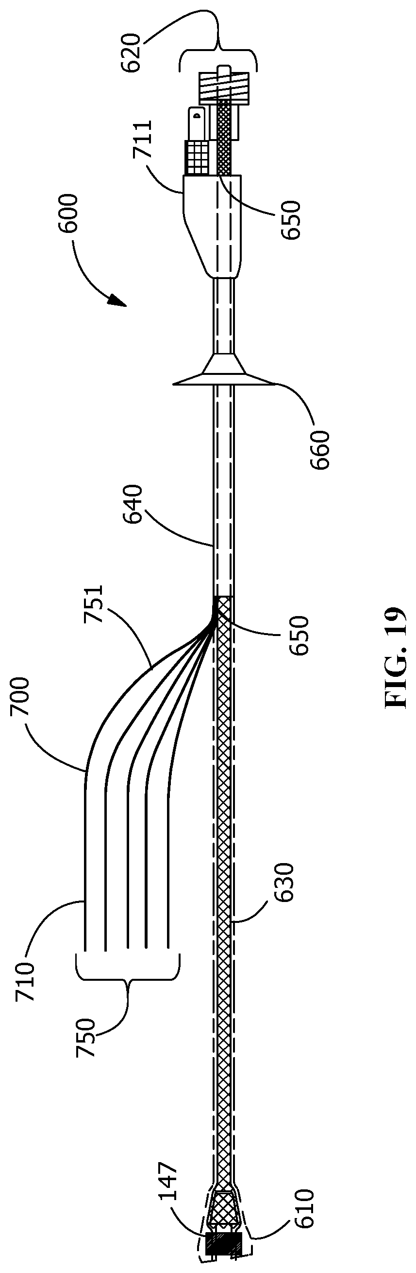 Patent US12350481 Figure 9 – Pressure unloading left ventricular assist device and methods for assisting a human heart