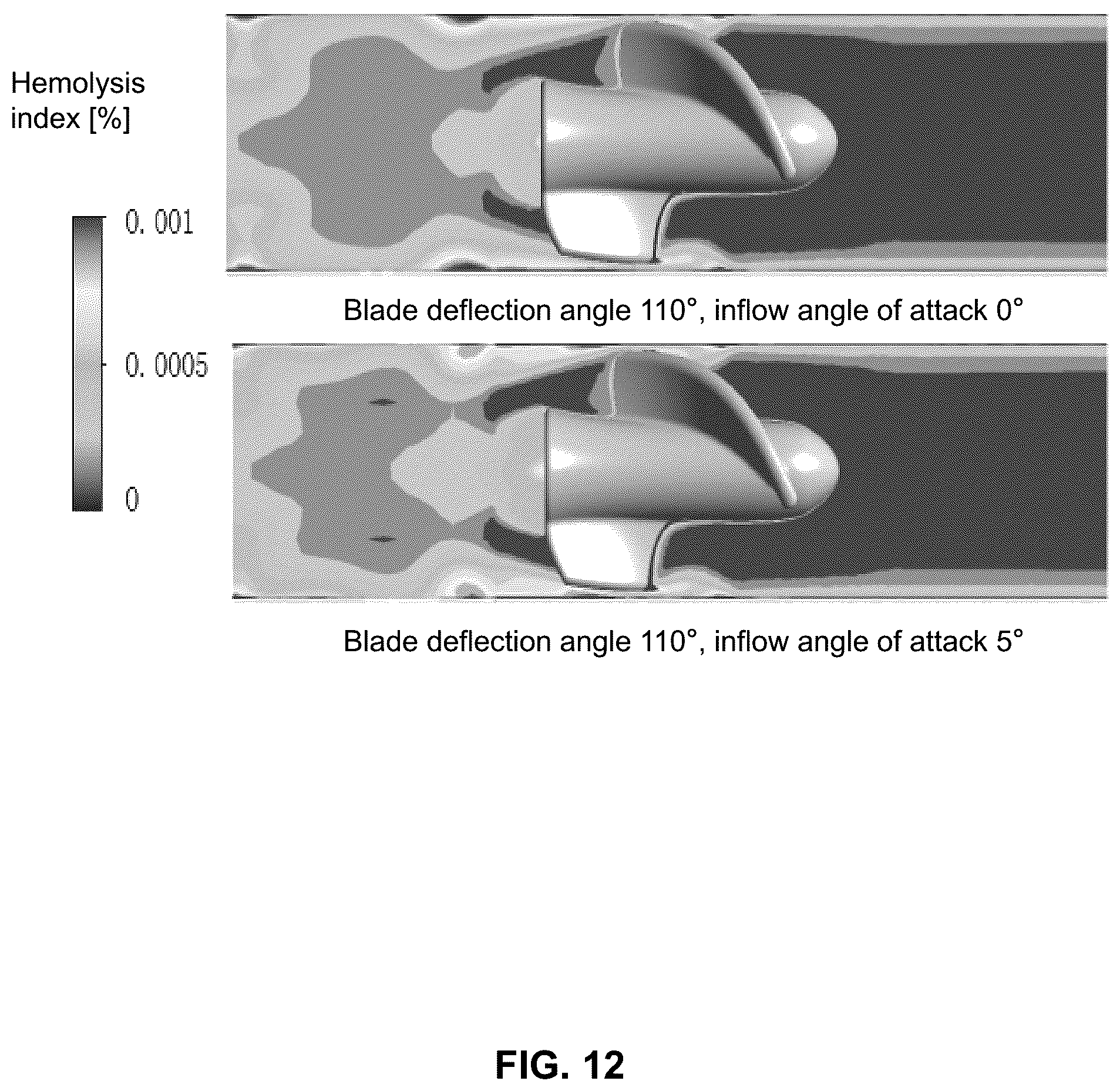Patent US12350482 Figure 12 – Impeller and ventricular assist device