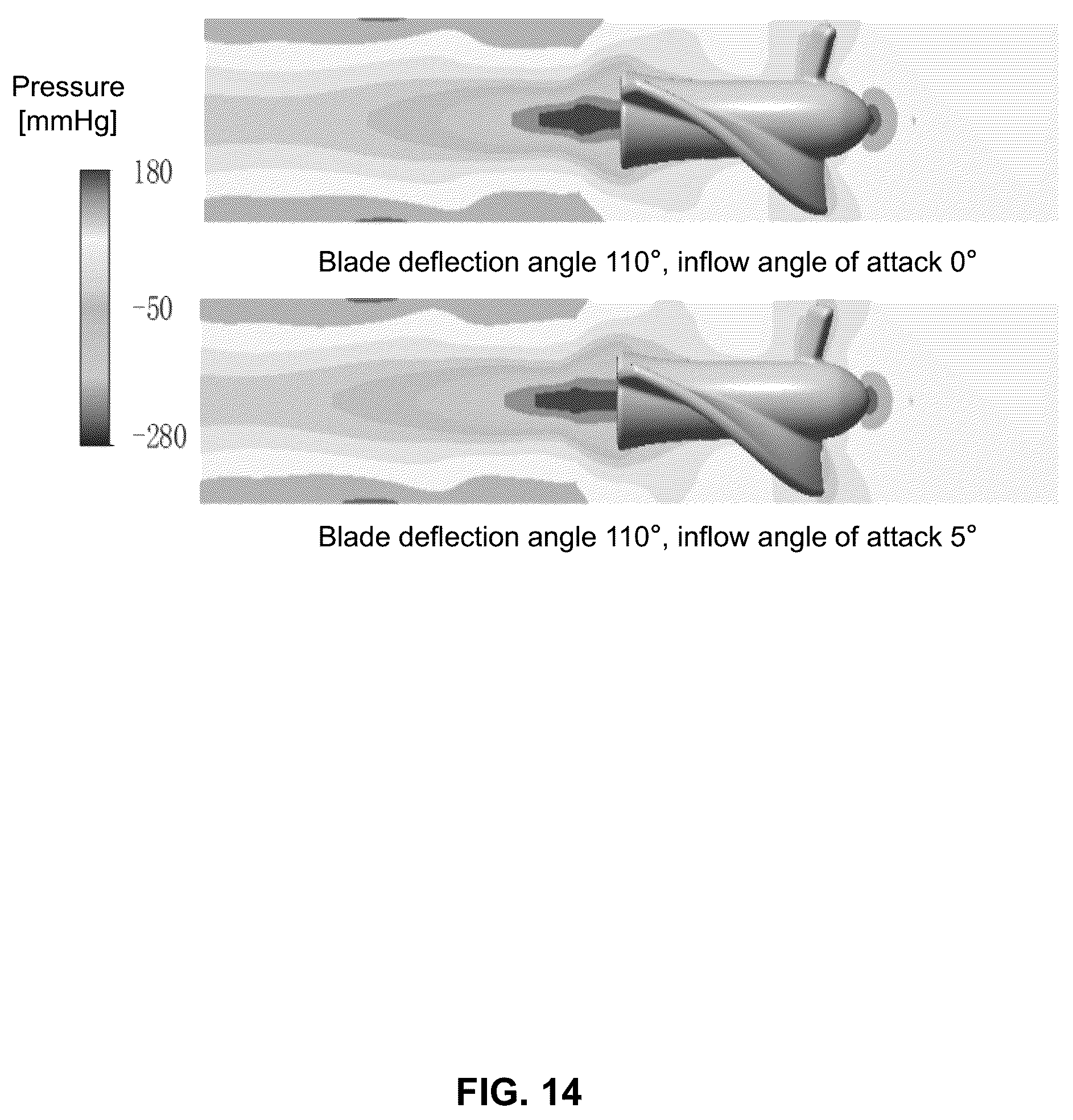 Patent US12350482 Figure 14 – Impeller and ventricular assist device