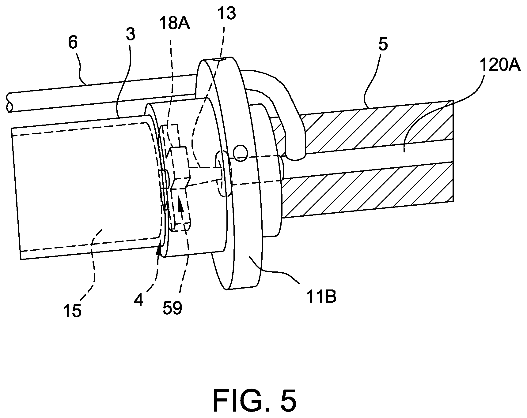 Patent US12350483 Figure 8 – Fluid seals for catheter pump motor assembly