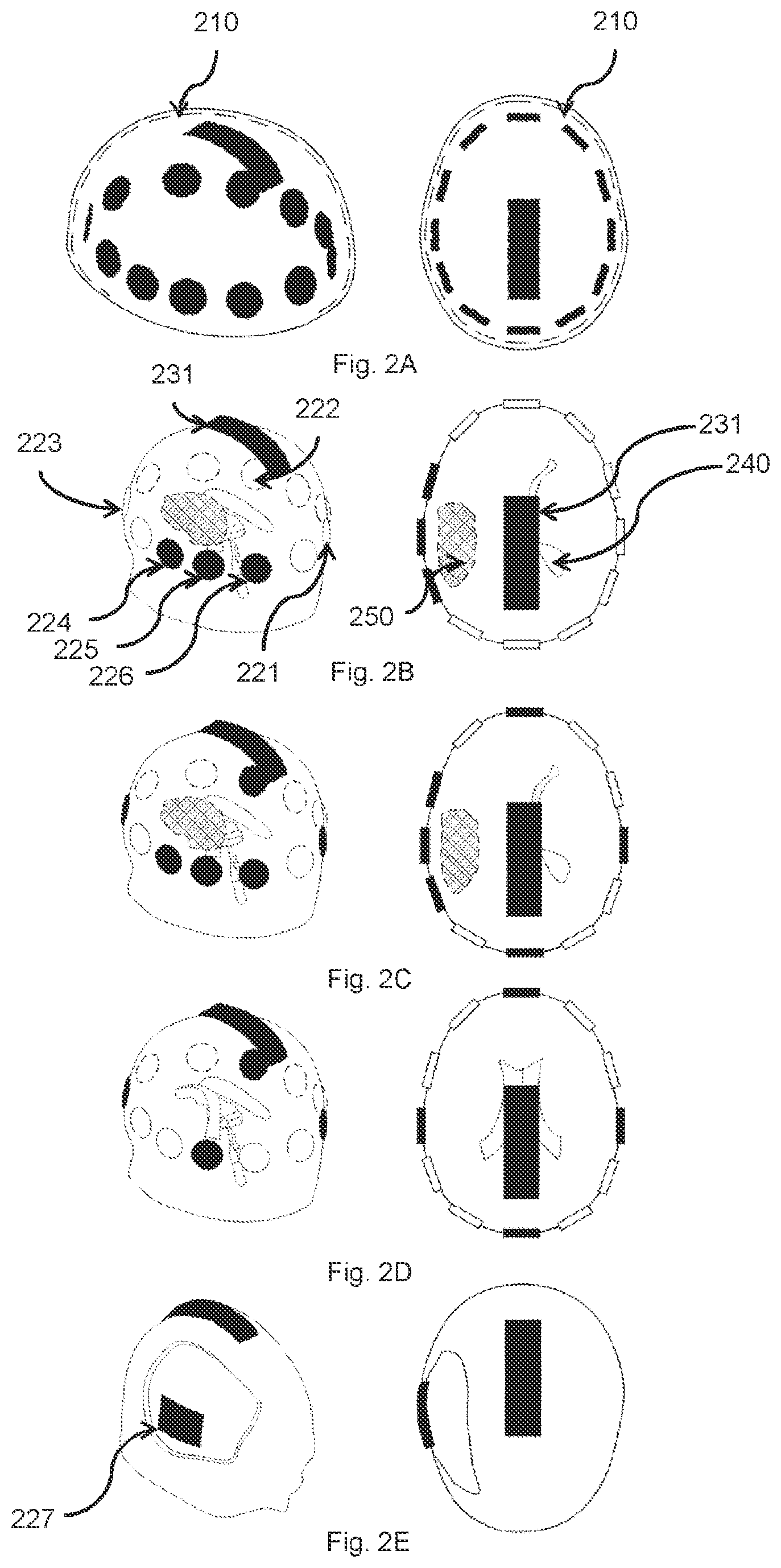 Patent US12350485 Figure 2 – Treatment device