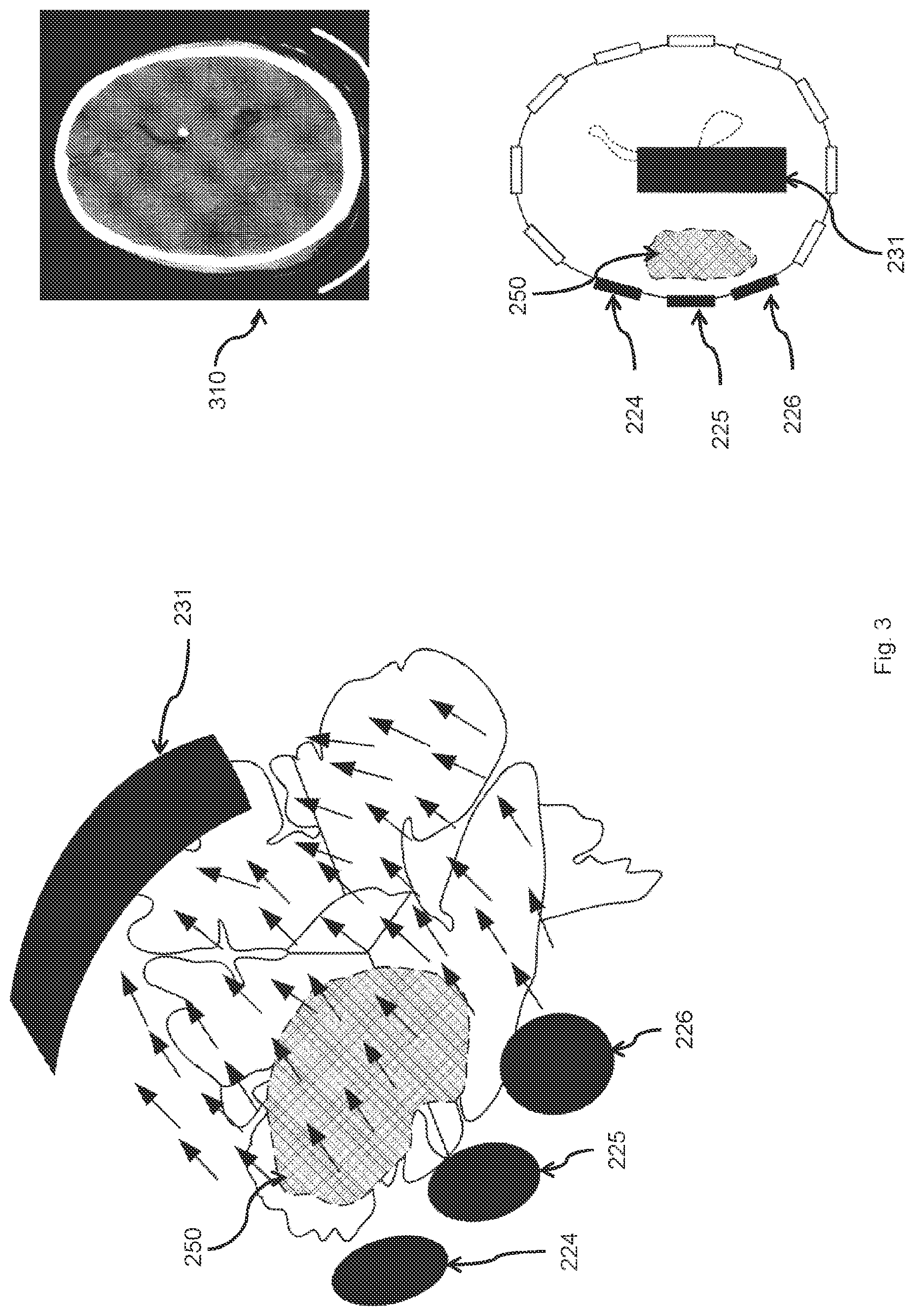 Patent US12350485 Figure 3 – Treatment device