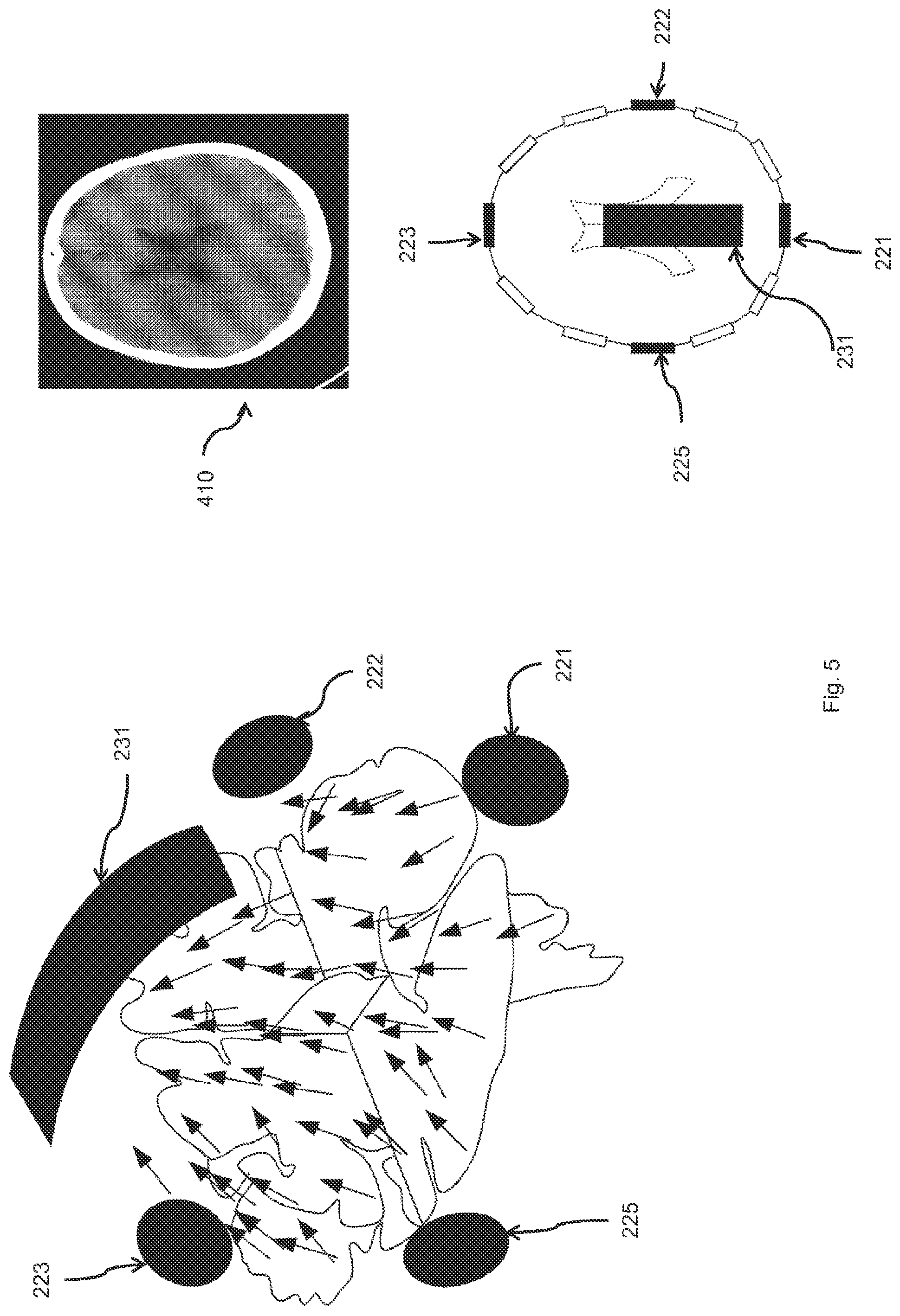 Patent US12350485 Figure 5 – Treatment device