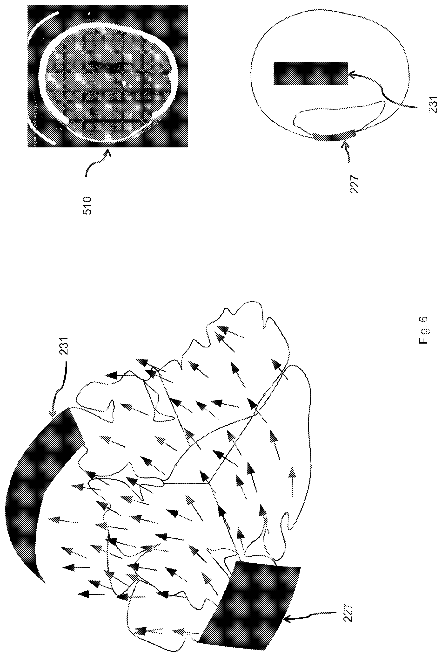 Patent US12350485 Figure 6 – Treatment device