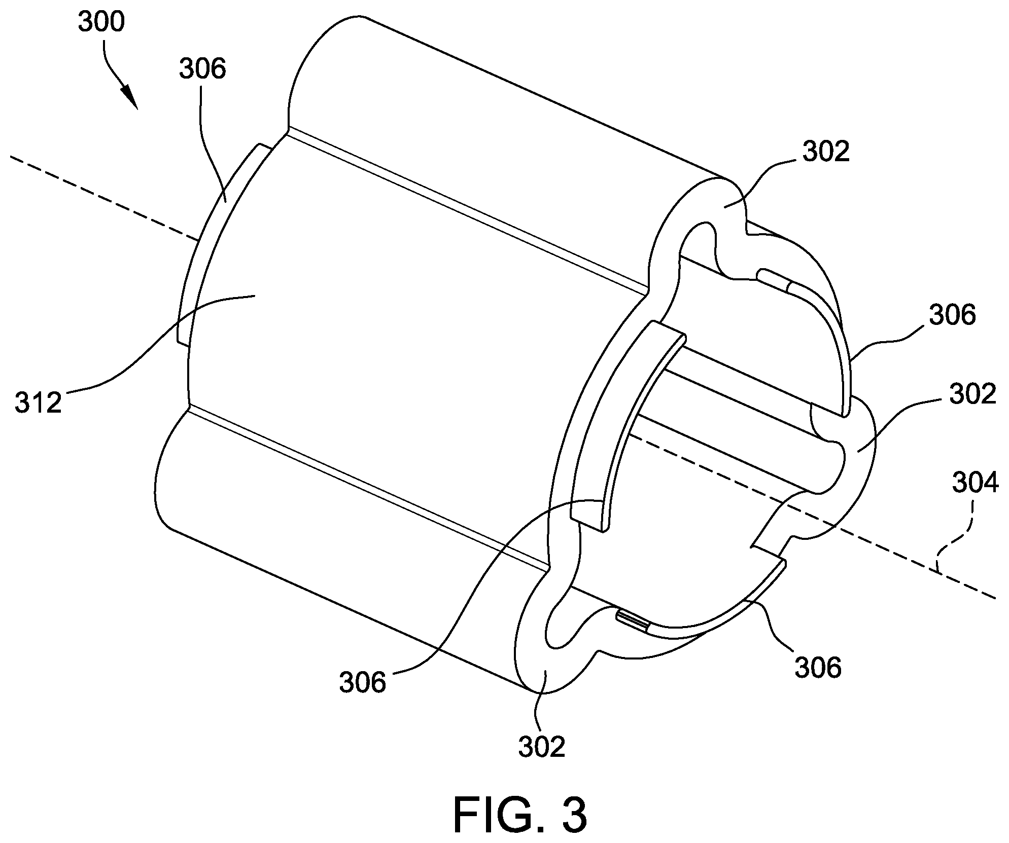 Patent US12350487 Figure 3 – Methods for fabricating segmented electrodes