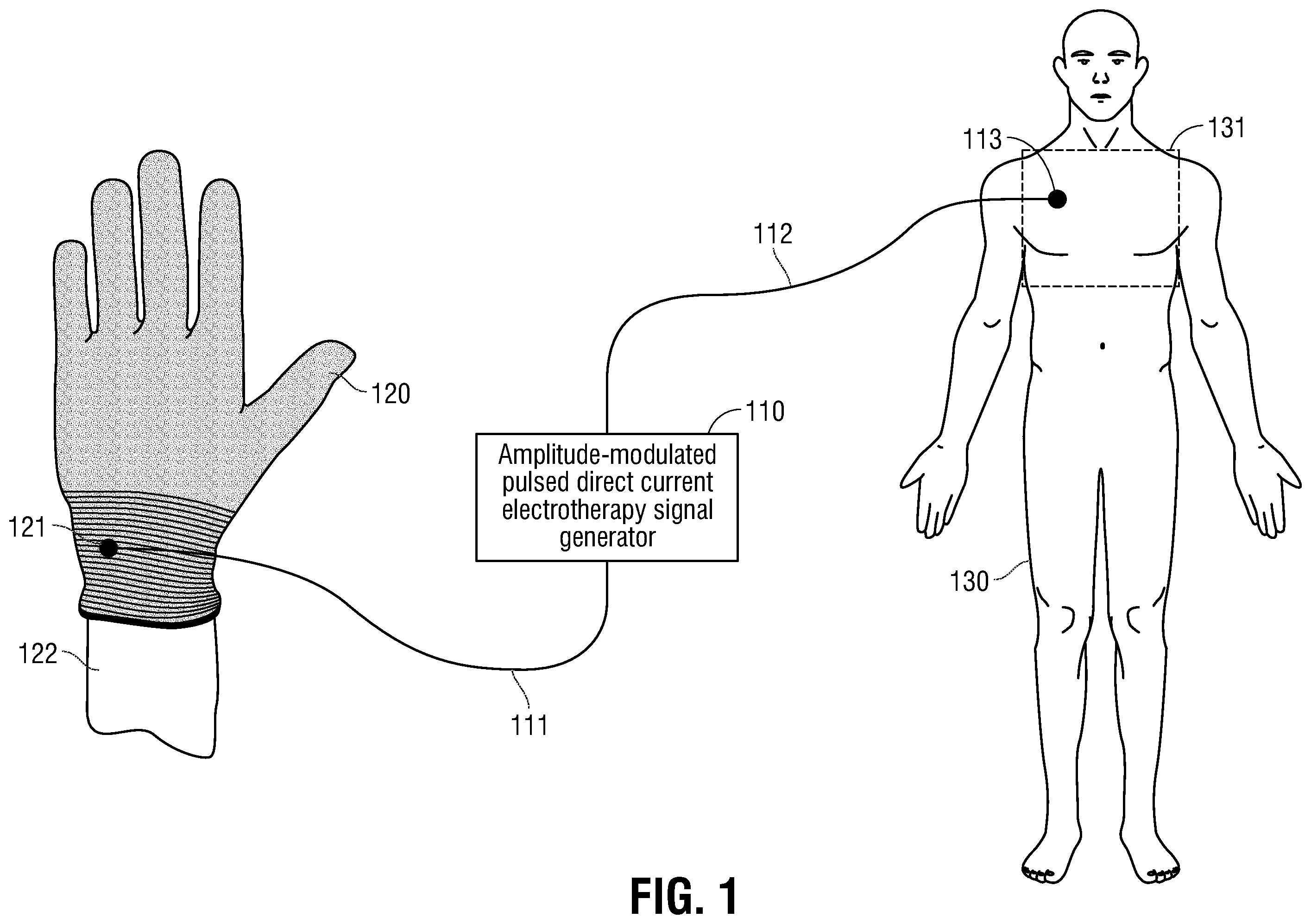 Patent US12350490 Figure 1 – Electrotherapy glove for delivery of amplitude modulated pulsed direct current during manual therapy treatment