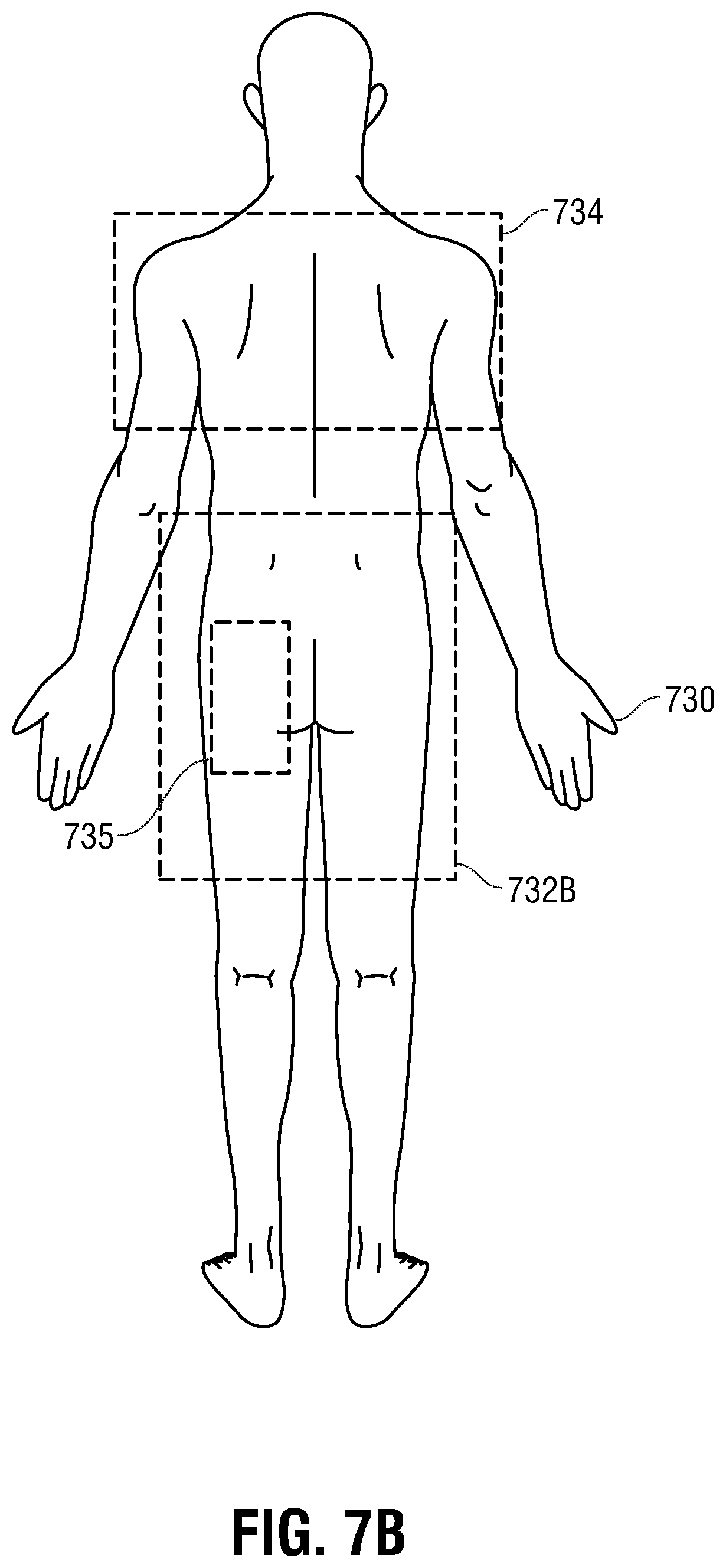 Patent US12350490 Figure 8 – Electrotherapy glove for delivery of amplitude modulated pulsed direct current during manual therapy treatment