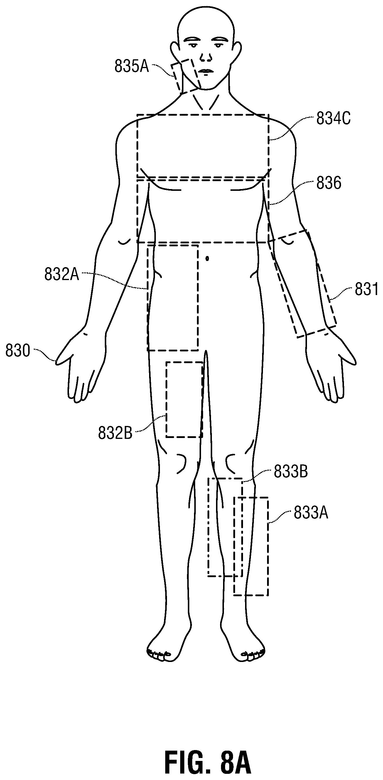 Patent US12350490 Figure 9 – Electrotherapy glove for delivery of amplitude modulated pulsed direct current during manual therapy treatment
