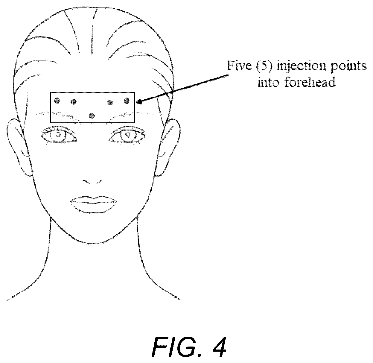 Patent US12350491 Figure 3 – Method for determining facial muscle responses