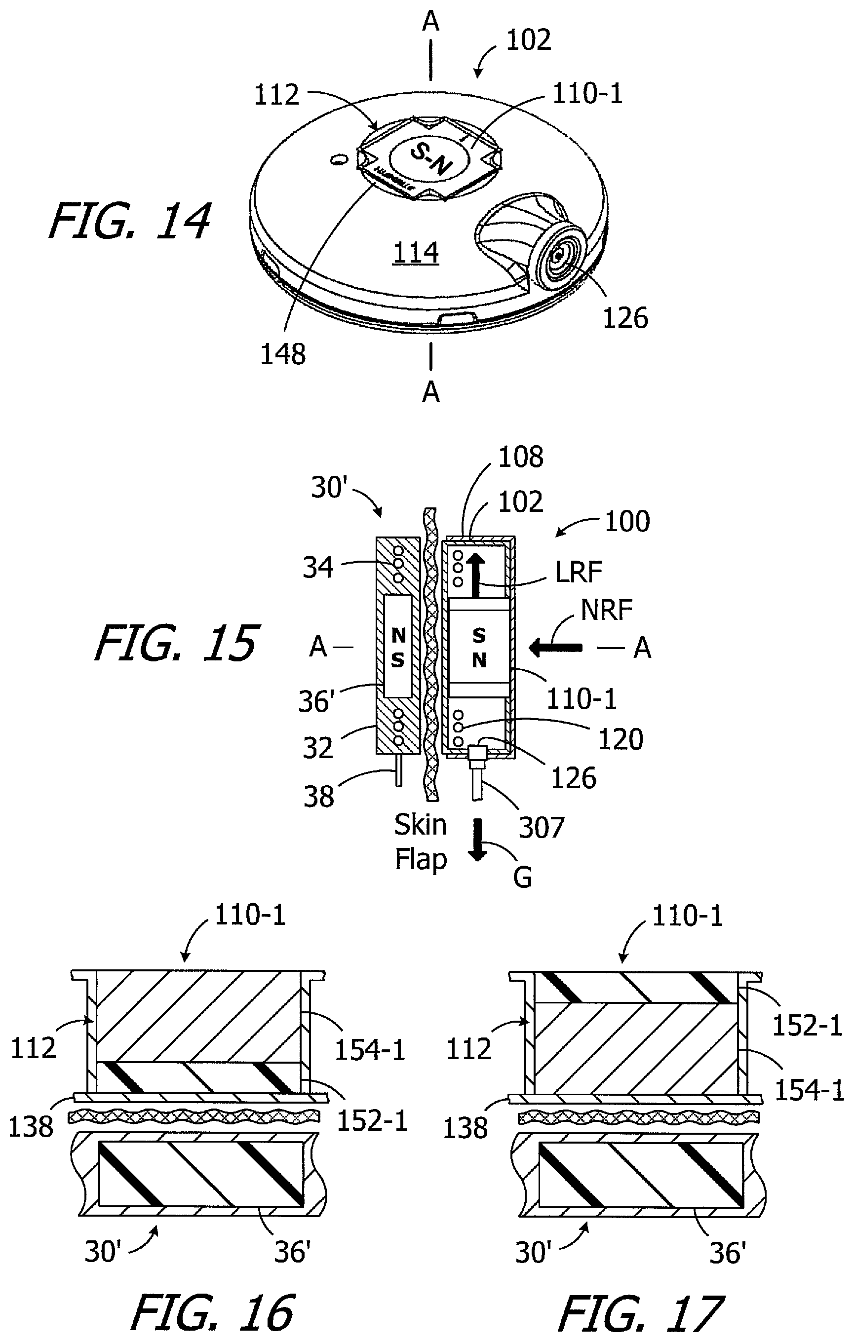Patent US12350493 Figure 4 – Headpieces and implantable cochlear stimulation systems including the same