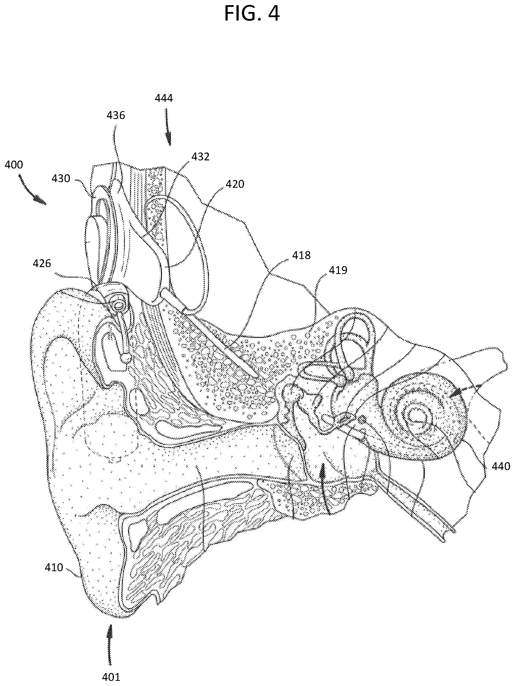 Patent US12350494 Figure 4 – Systems and methods for non-obtrusive adjustment of auditory prostheses