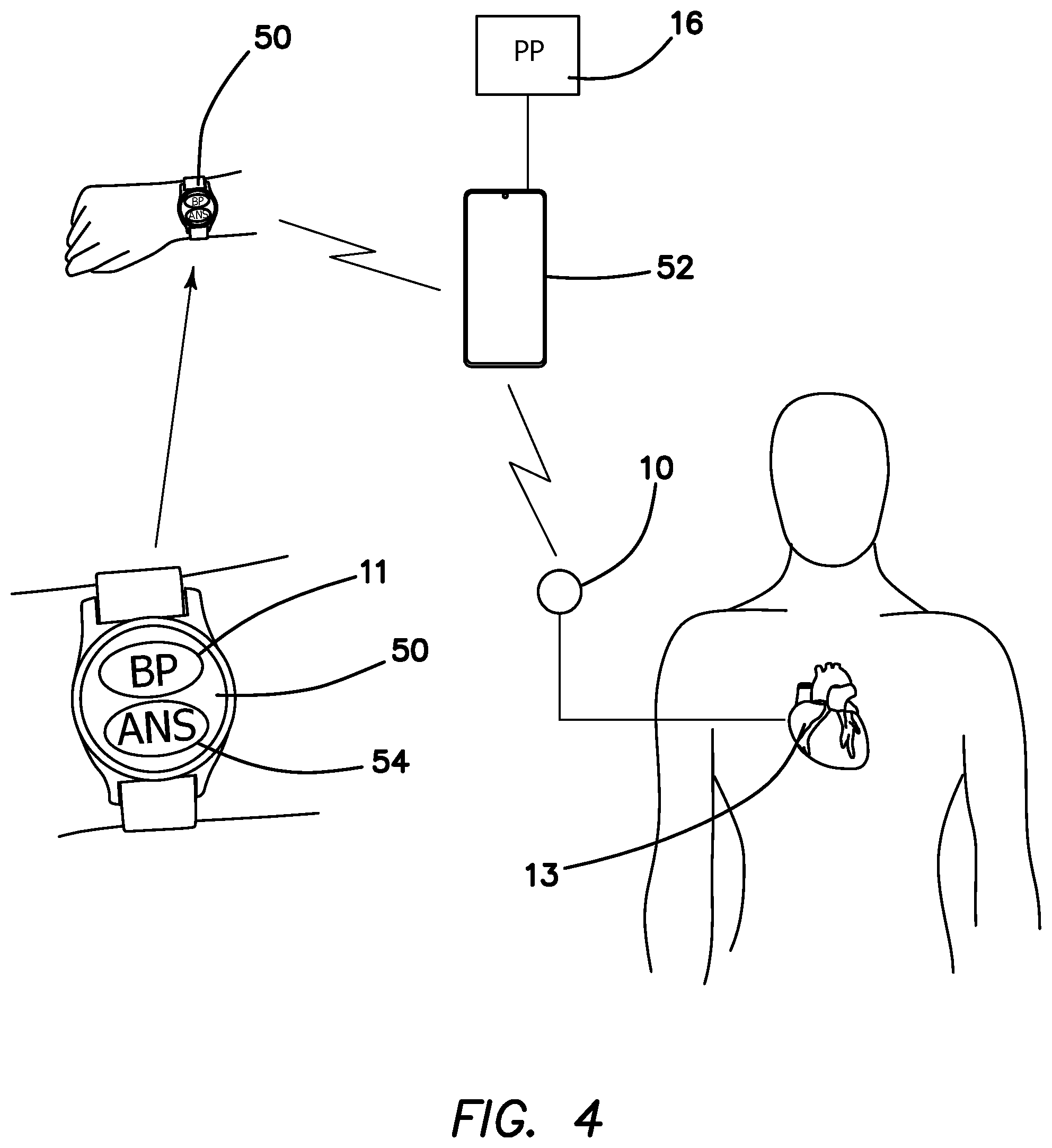 Patent US12350495 Figure 4 – Method of treatment of drug resistant hypertension