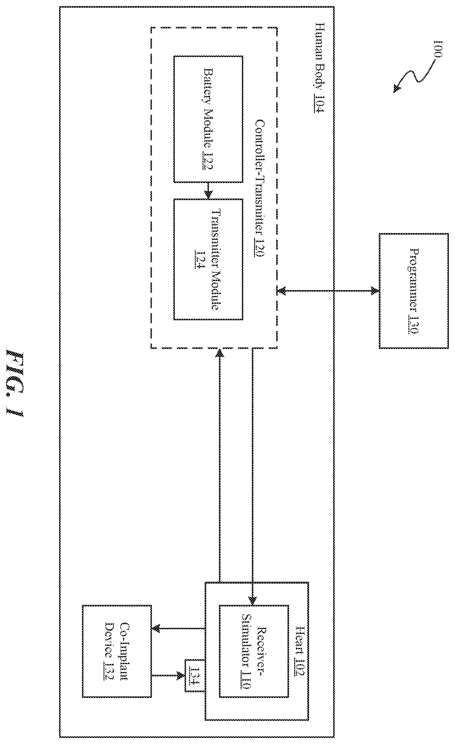 Patent US12350497 Figure 1 – Tissue stimulation systems and methods, such as for pacing cardiac tissue