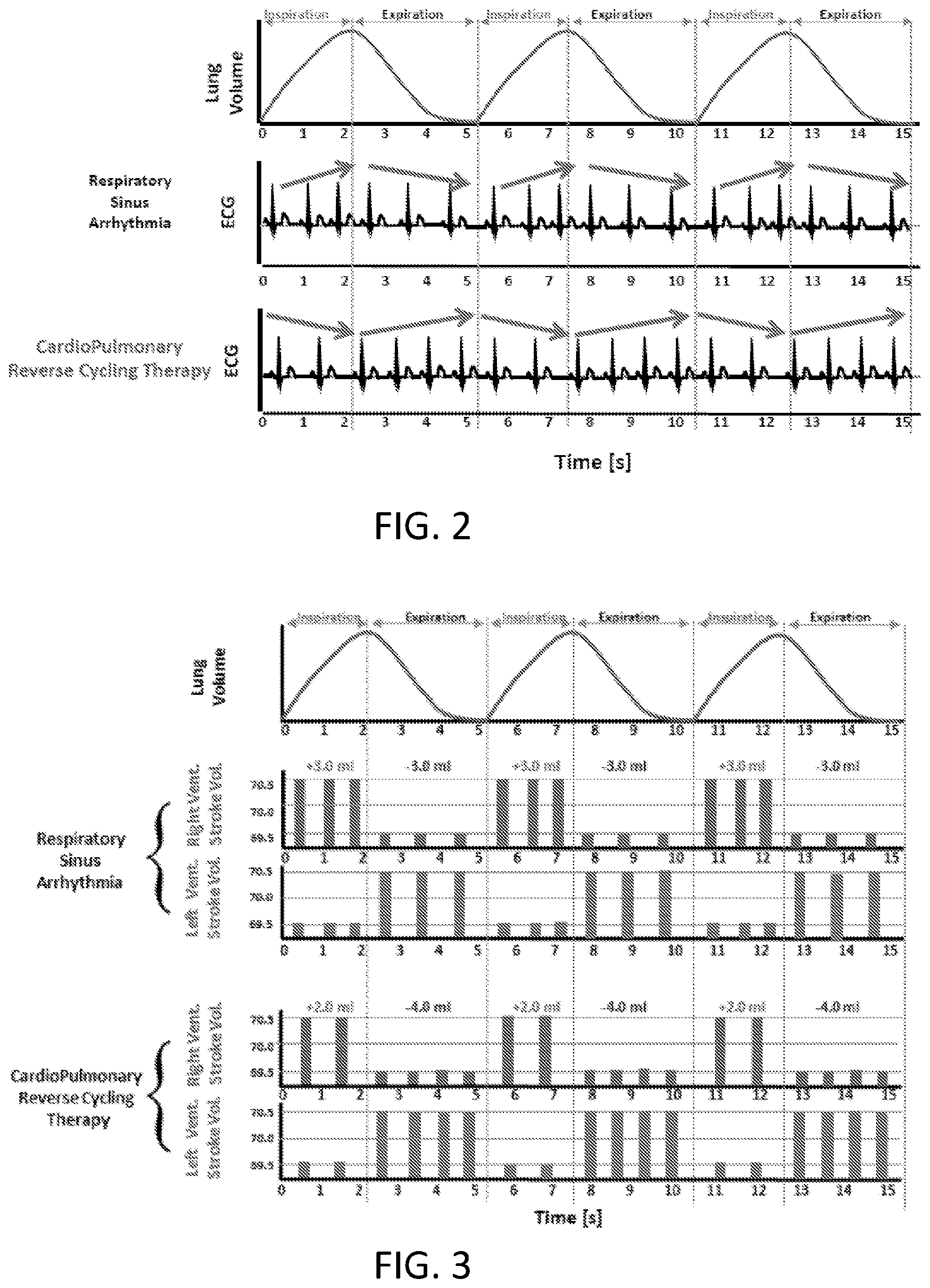Patent US12350498 Figure 2 – Treatment of cardiac decompensation, pulmonary congestion and dyspnea