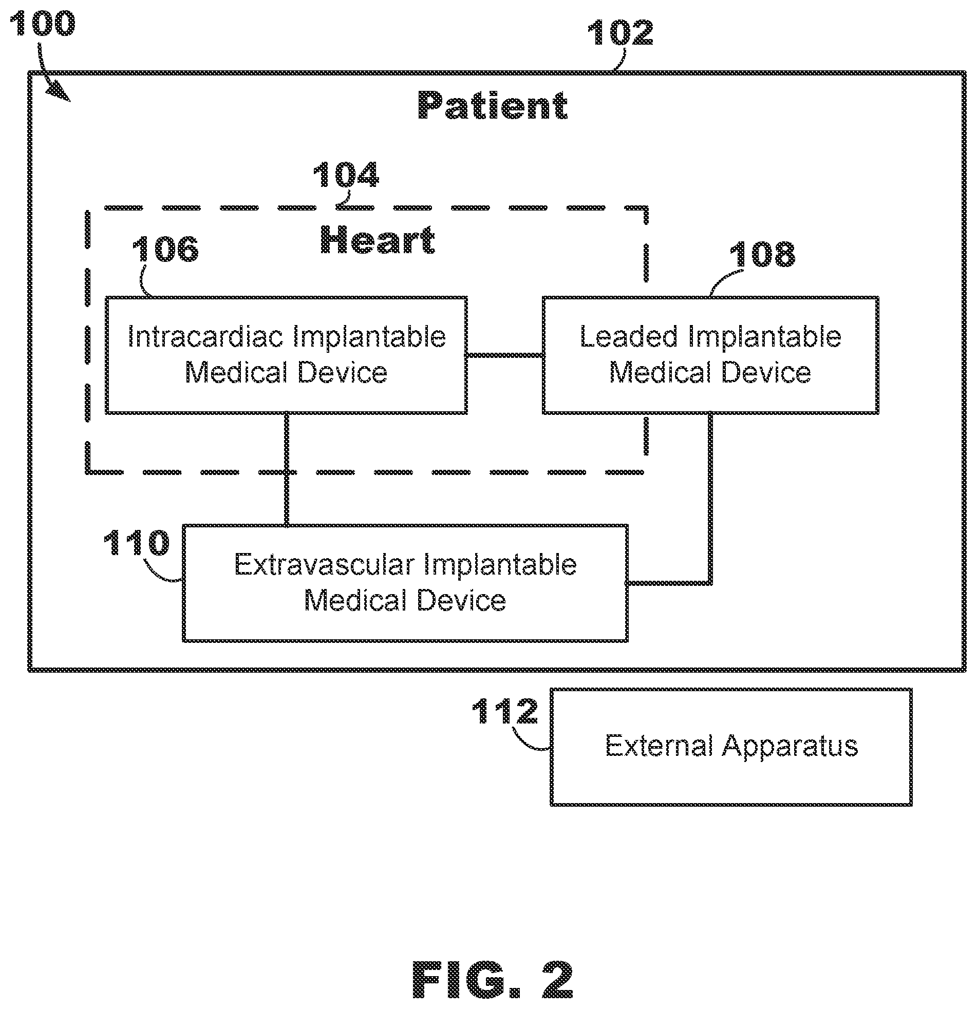 Patent US12350500 Figure 2 – AV synchronous septal pacing