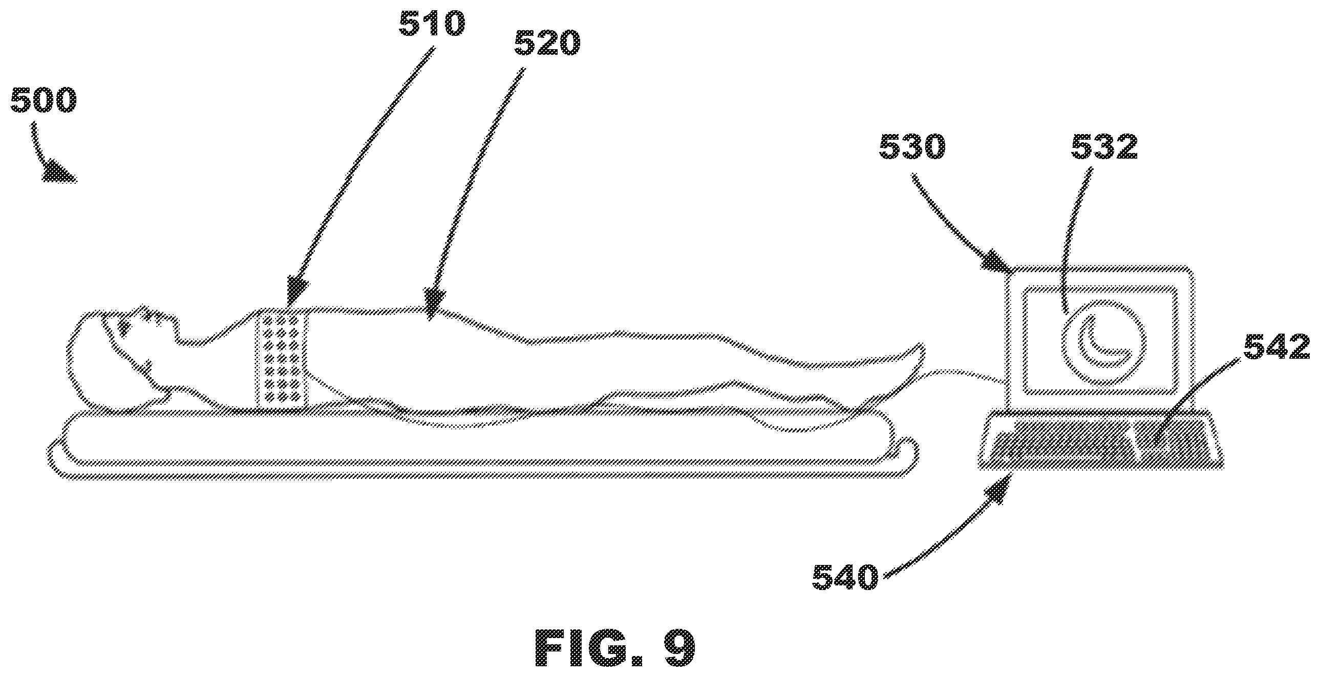 Patent US12350500 Figure 9 – AV synchronous septal pacing