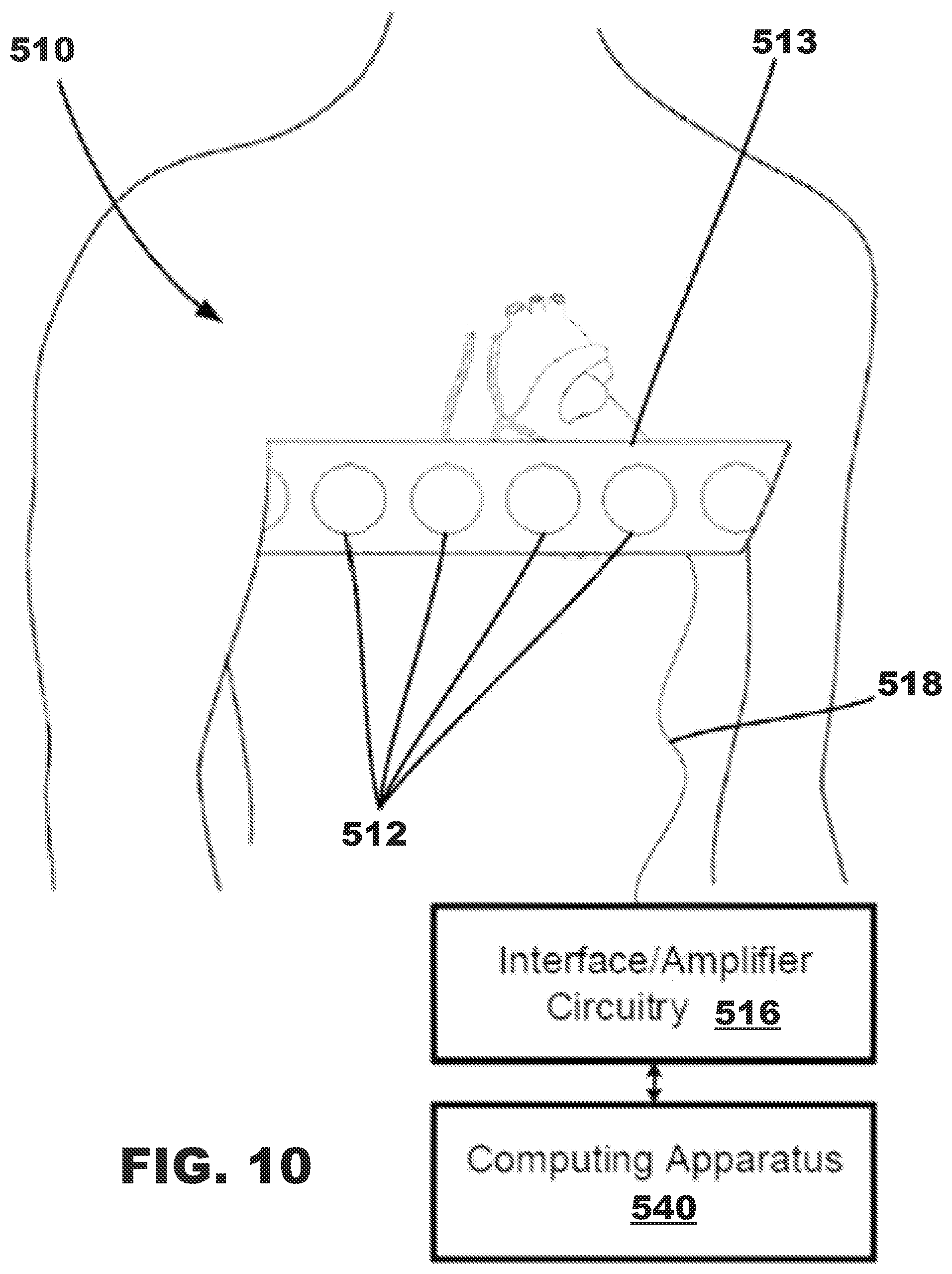 Patent US12350500 Figure 10 – AV synchronous septal pacing
