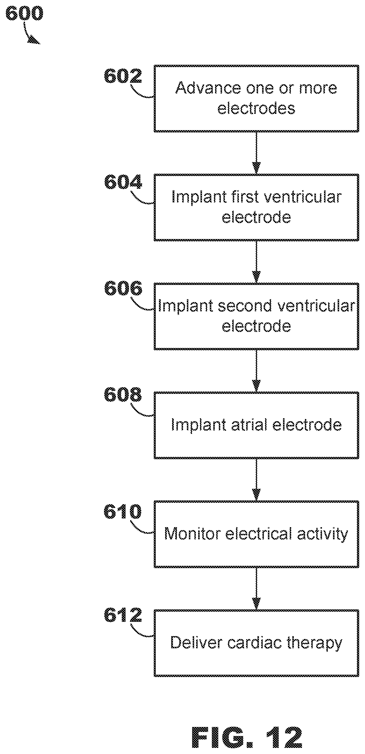 Patent US12350500 Figure 12 – AV synchronous septal pacing