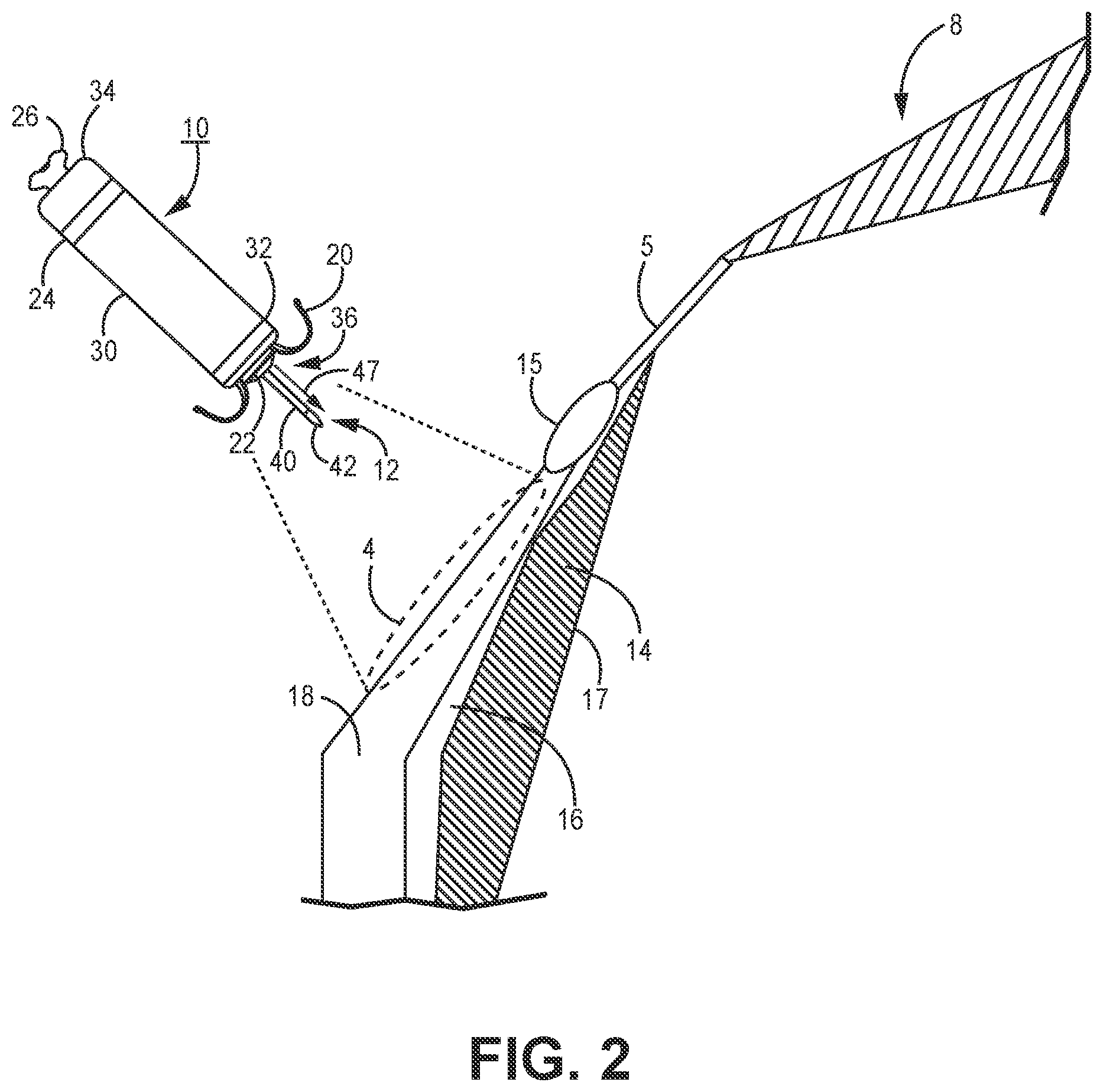 Patent US12350502 Figure 2 – Electrodes for intra-cardiac pacemaker
