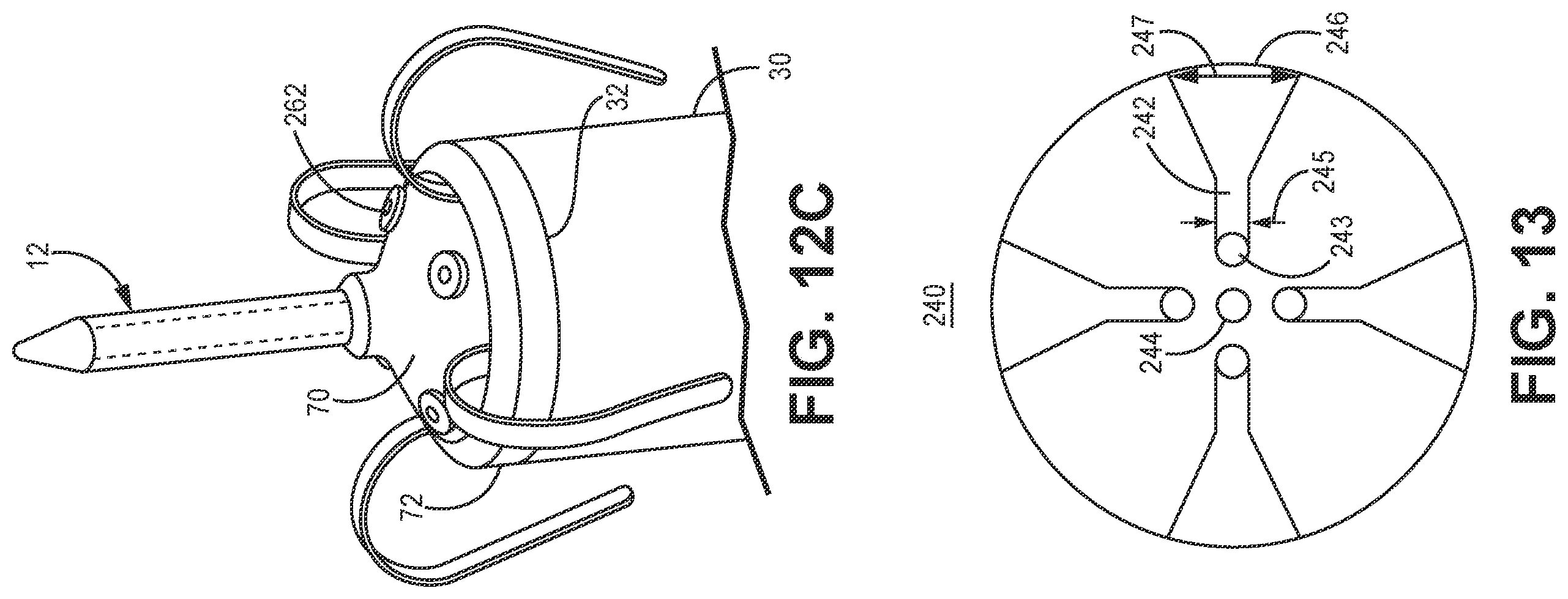 Patent US12350502 Figure 11 – Electrodes for intra-cardiac pacemaker