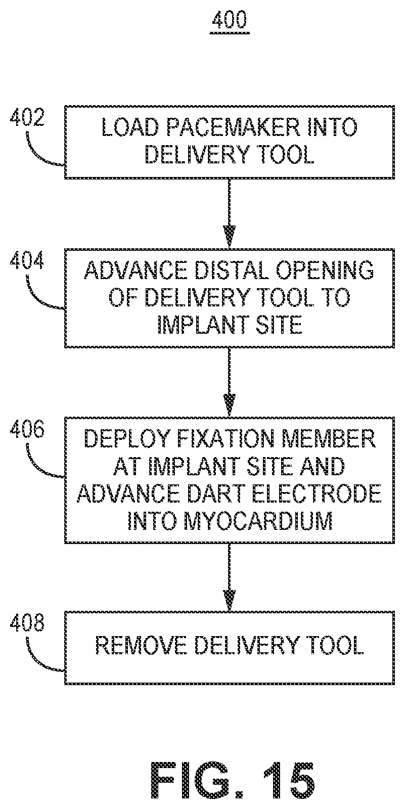 Patent US12350502 Figure 13 – Electrodes for intra-cardiac pacemaker