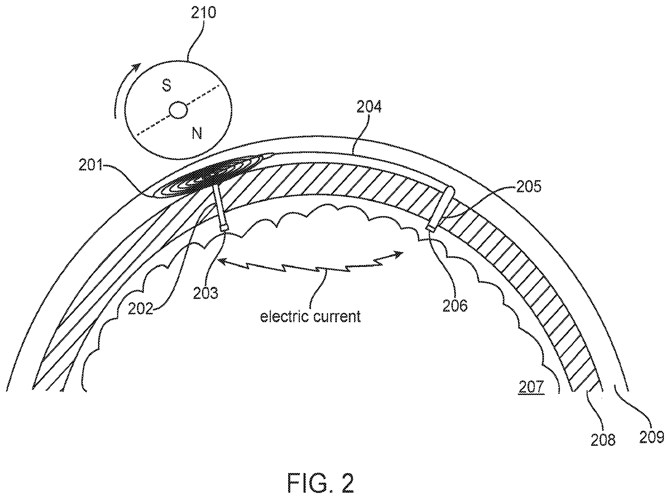 Patent US12350504 Figure 2 – System and method for transcranial current loop brain stimulation