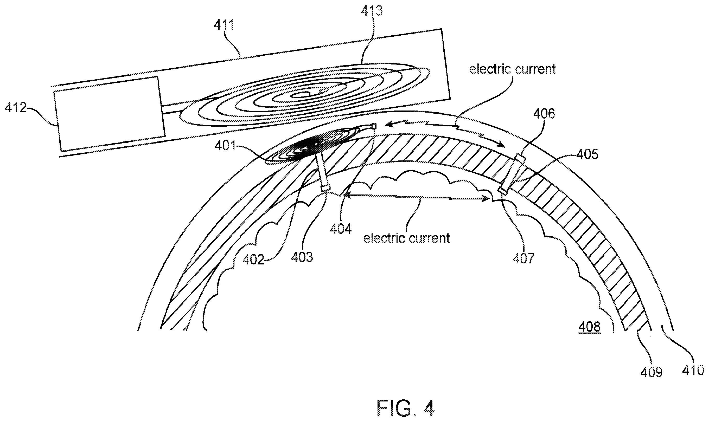 Patent US12350504 Figure 4 – System and method for transcranial current loop brain stimulation