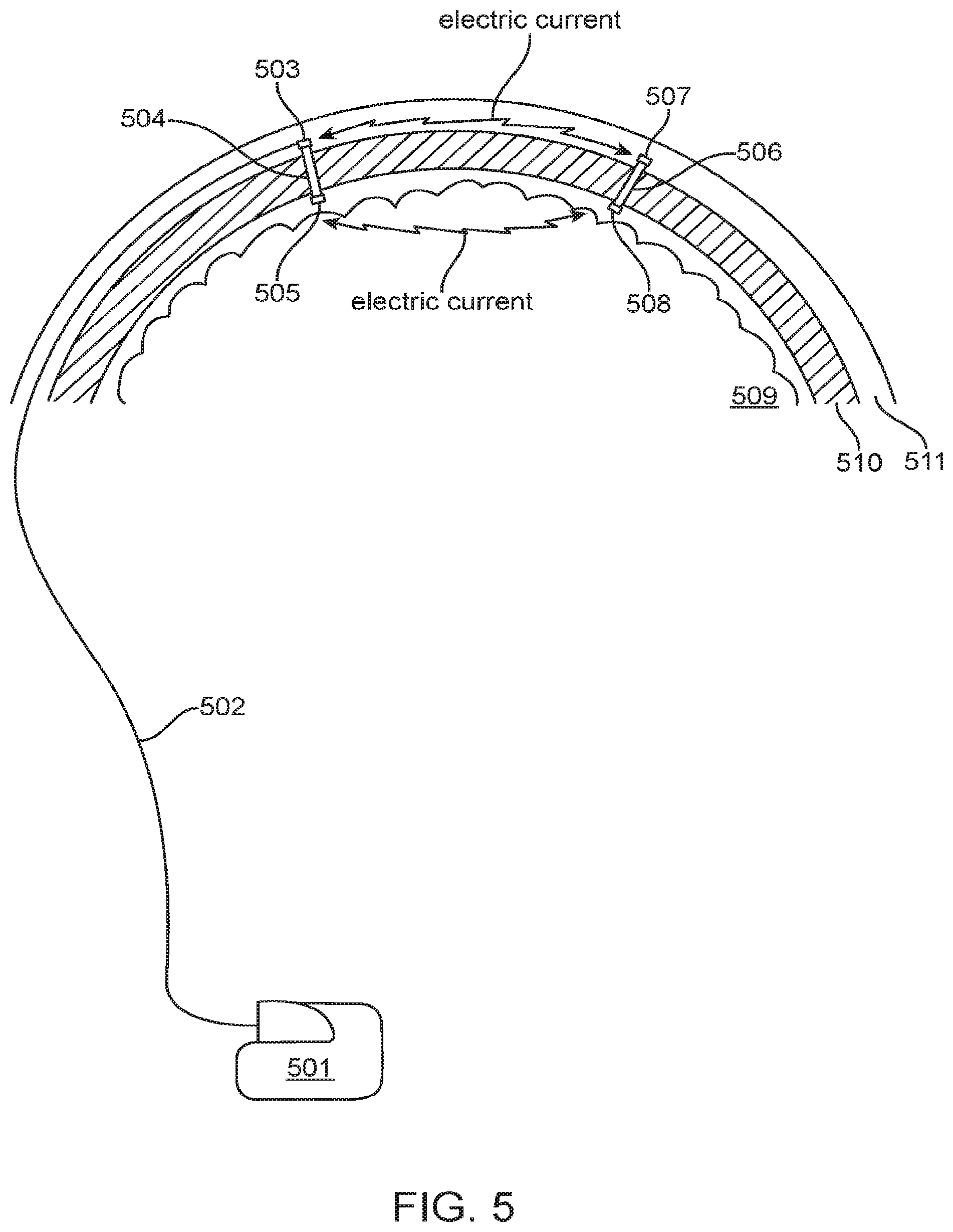 Patent US12350504 Figure 5 – System and method for transcranial current loop brain stimulation