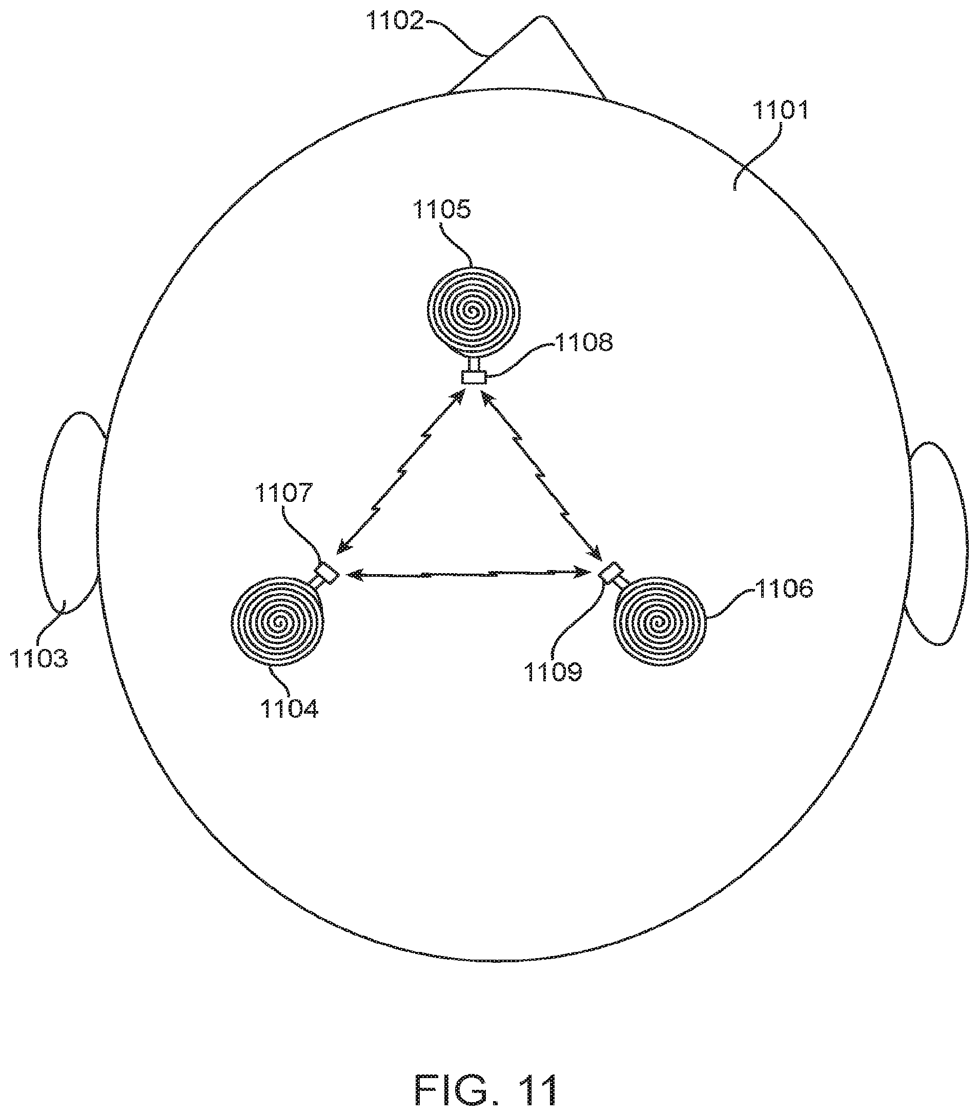 Patent US12350504 Figure 11 – System and method for transcranial current loop brain stimulation