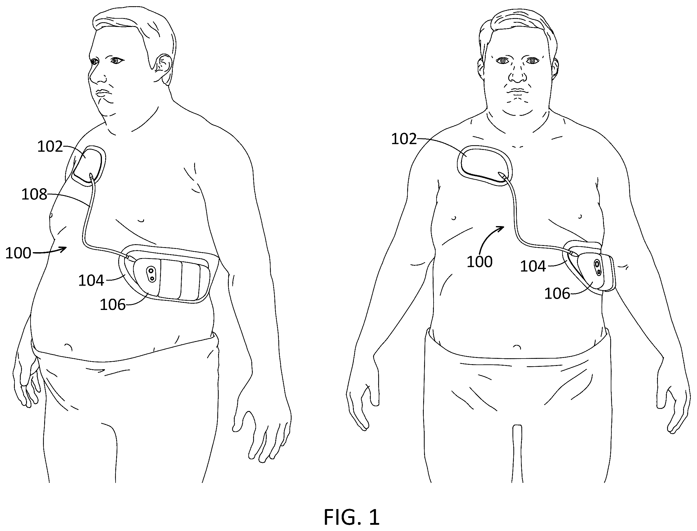 Patent US12350508 Figure 1 – Wearable devices